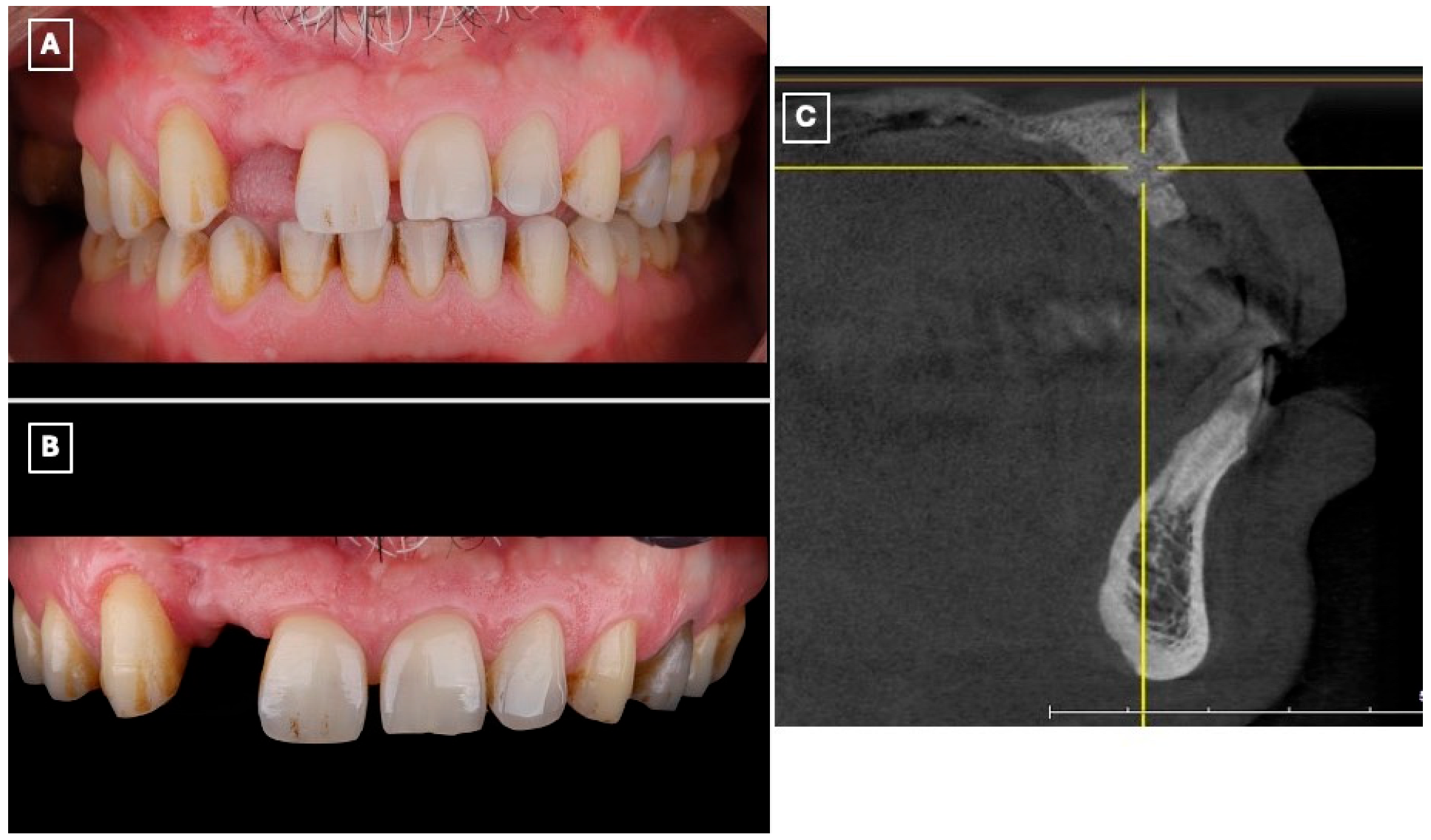 Prosthesis 08 00017 g001