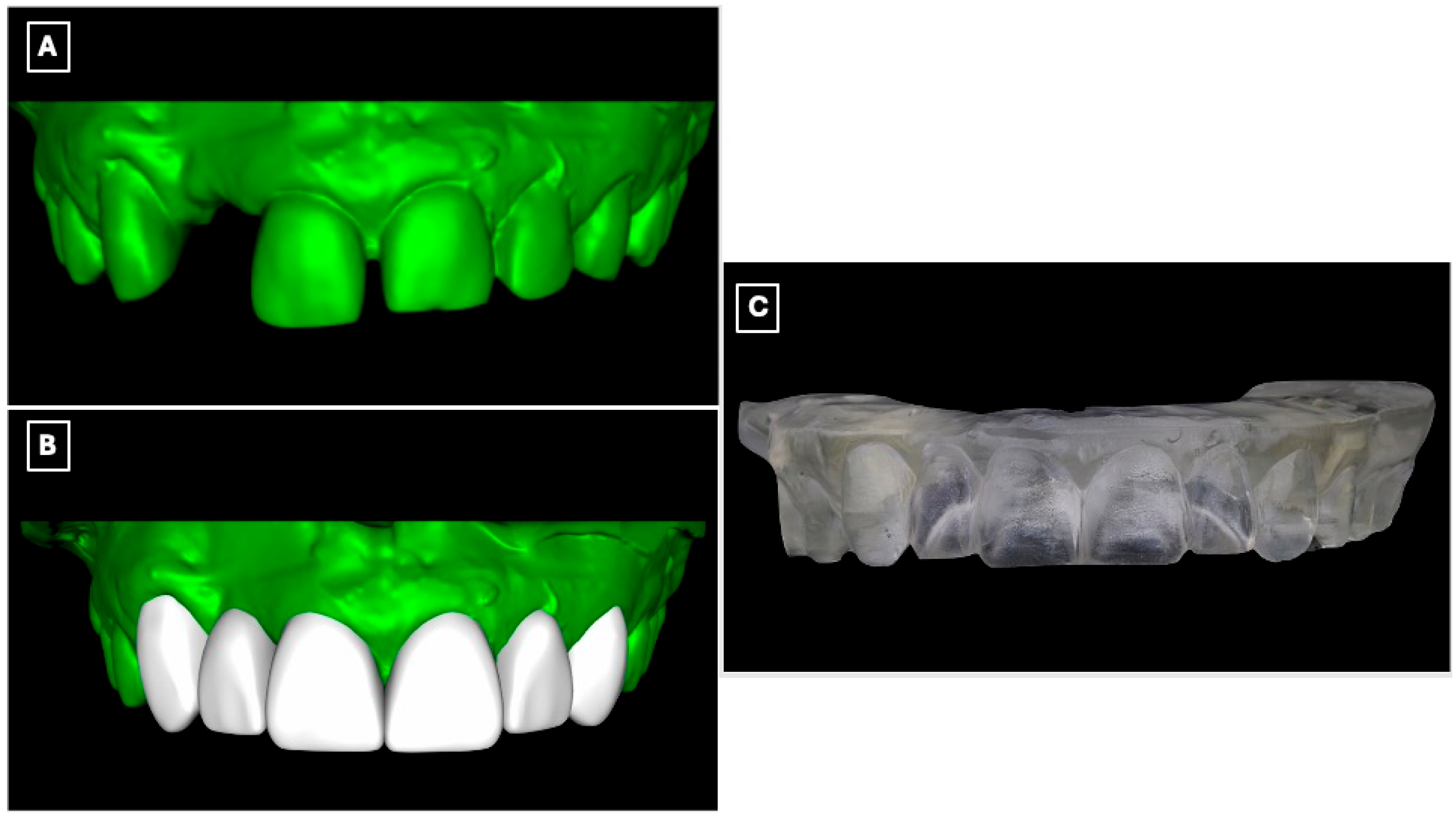 Prosthesis 08 00017 g002