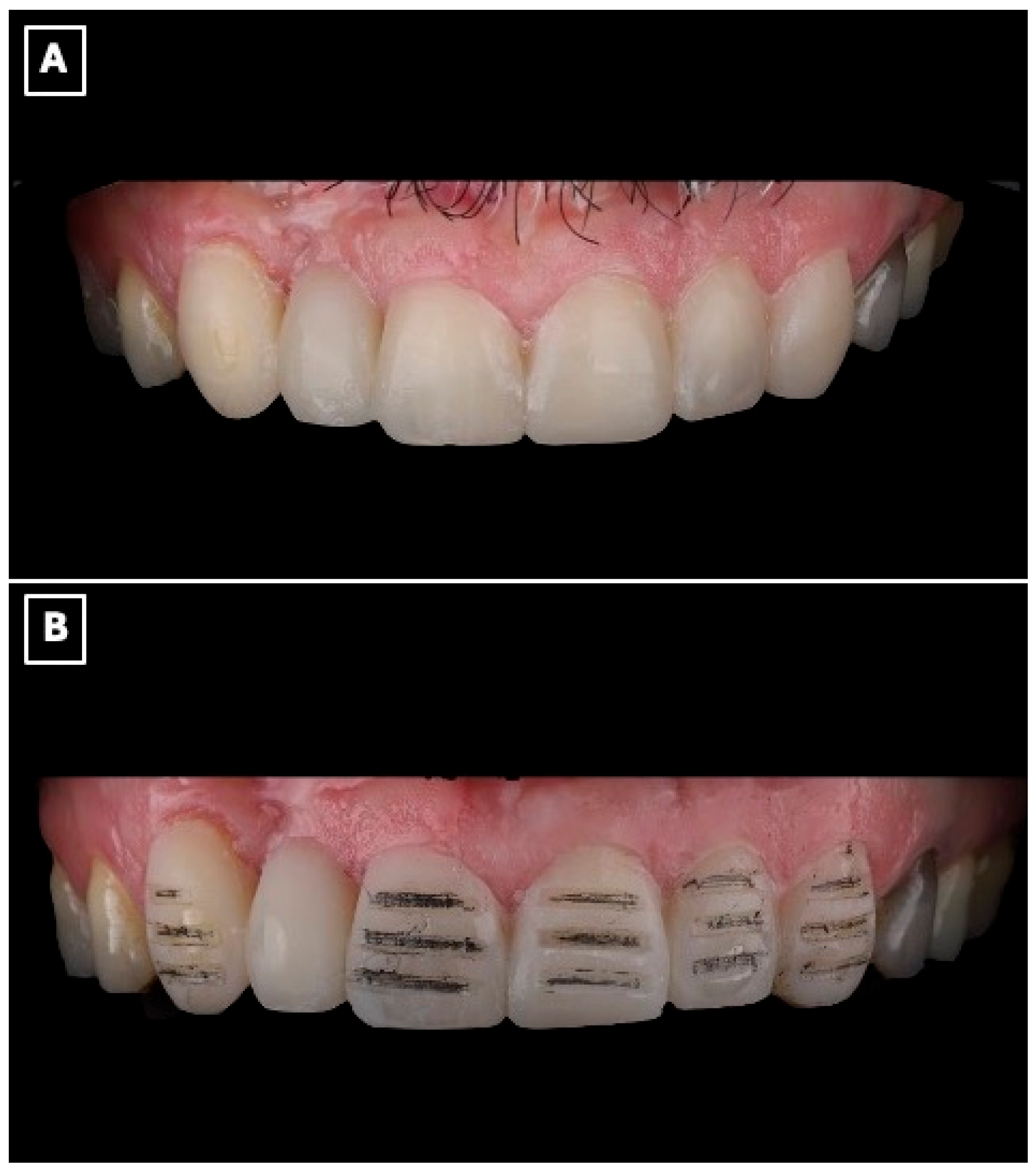 Prosthesis 08 00017 g003