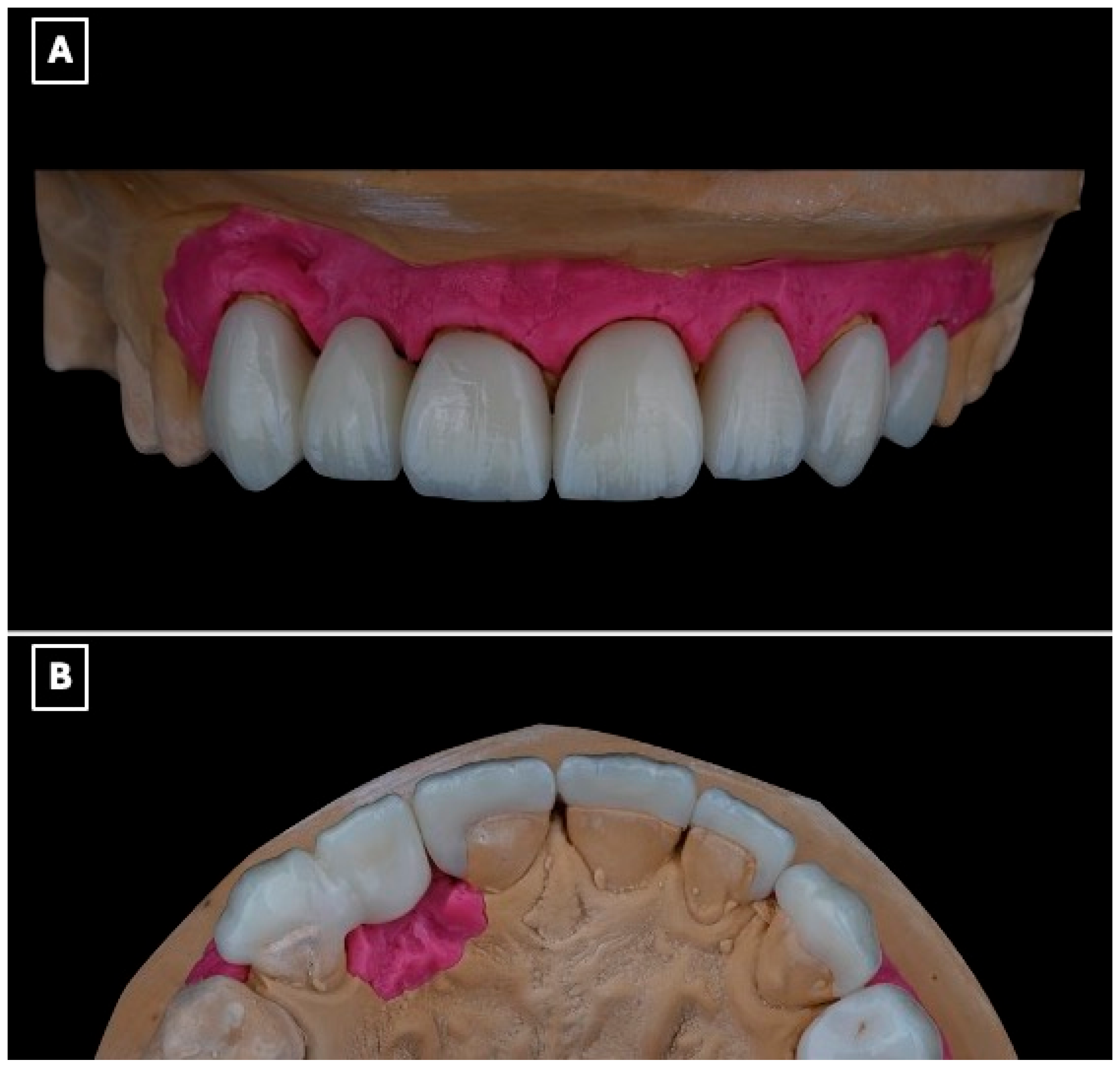 Prosthesis 08 00017 g004
