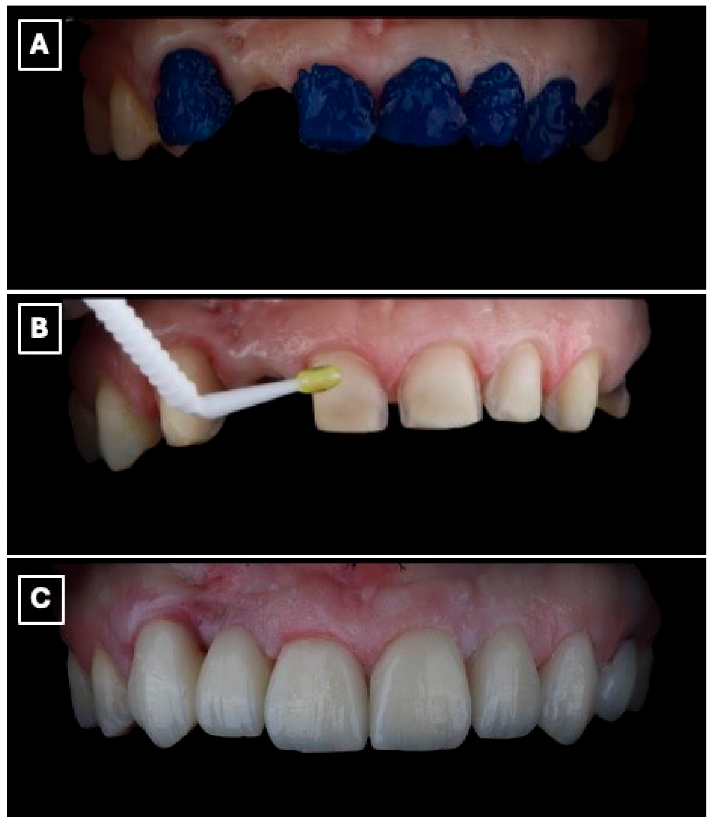 Prosthesis 08 00017 g006