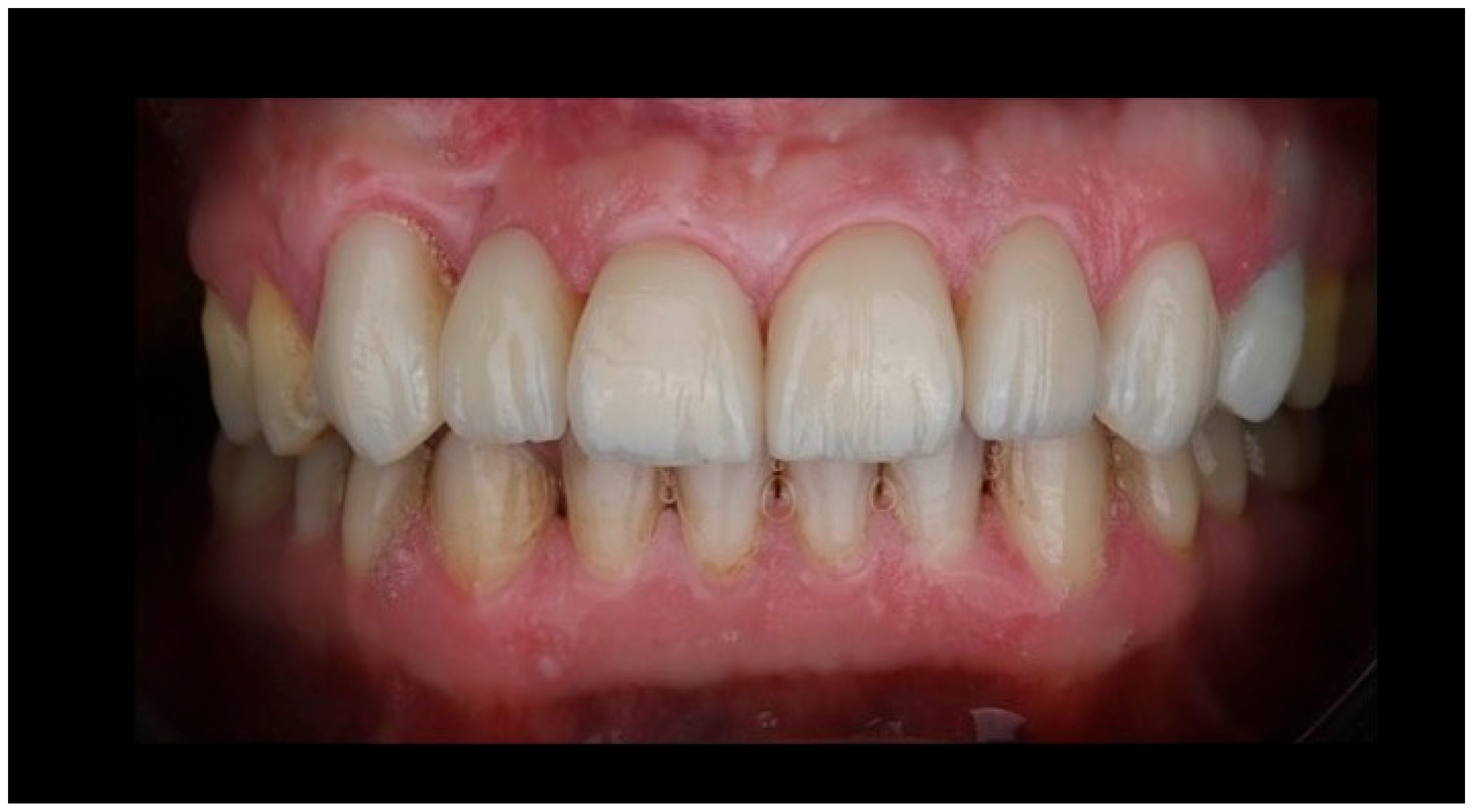 Prosthesis 08 00017 g007