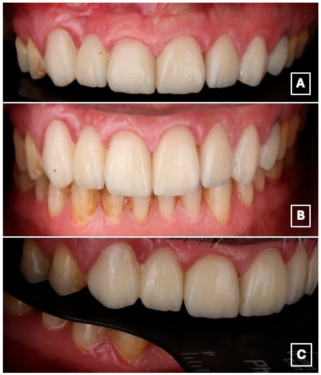 Prosthesis 08 00017 g008