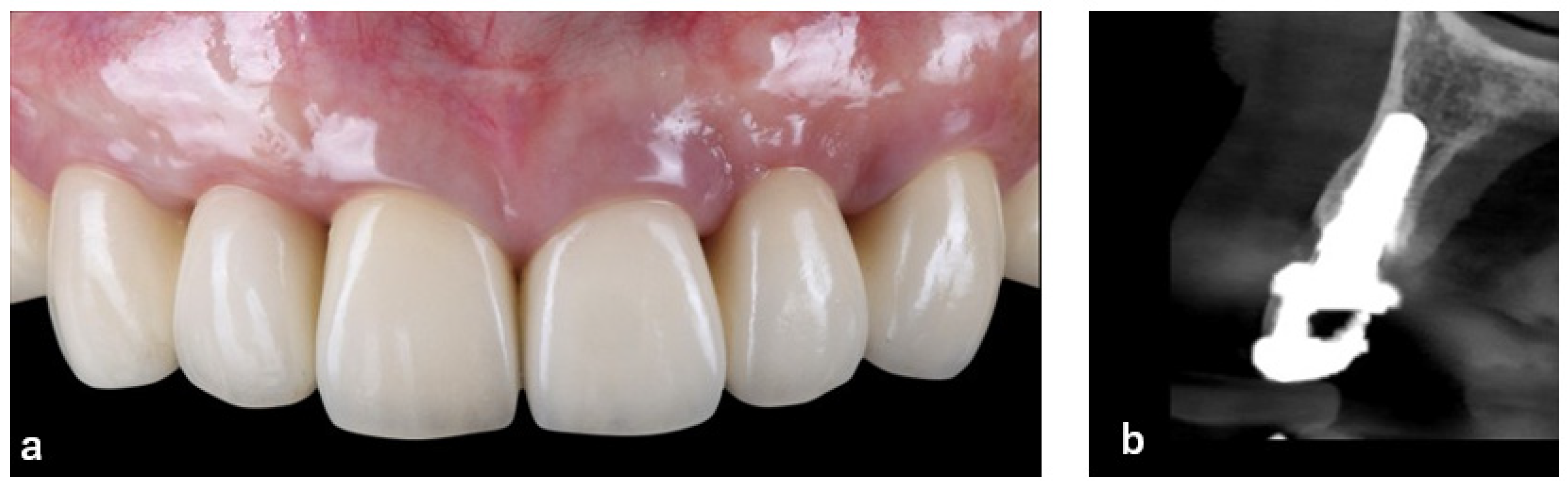 Prosthesis 08 00020 g013