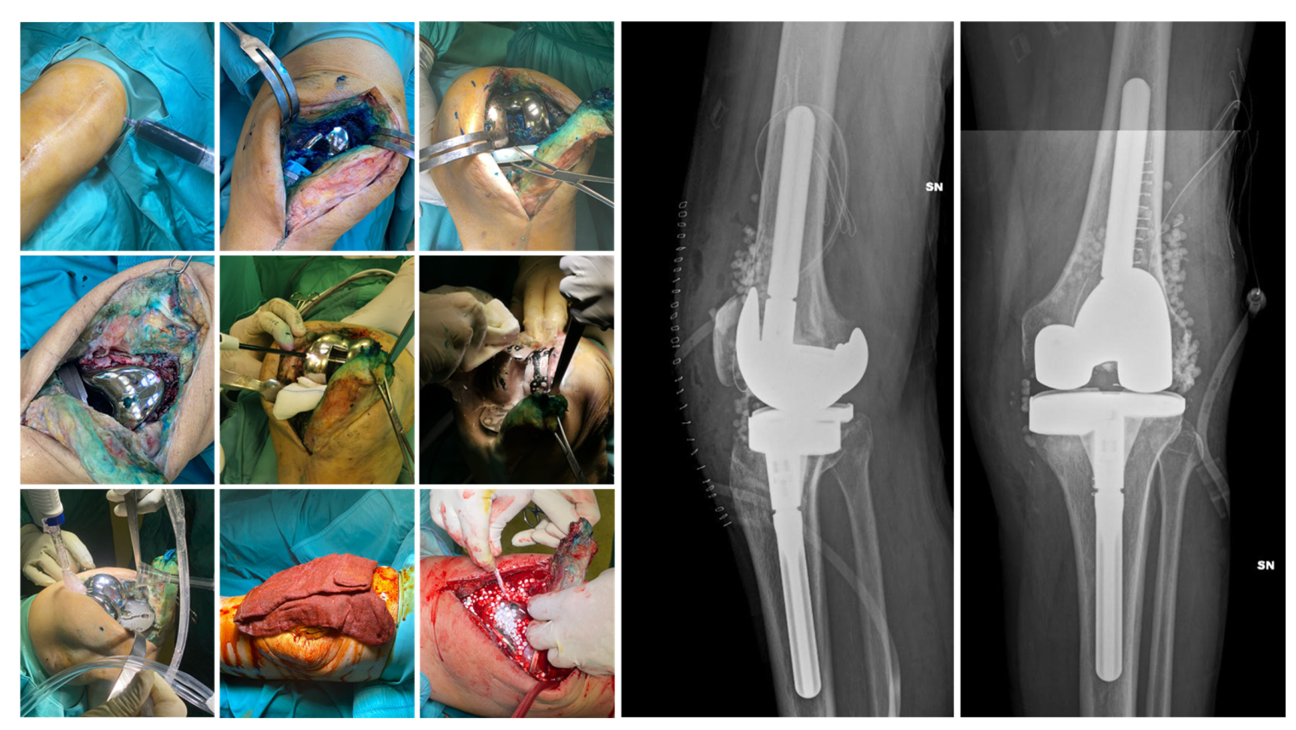 Prosthesis 08 00022 g002 Prosthesis 08 00022 g002