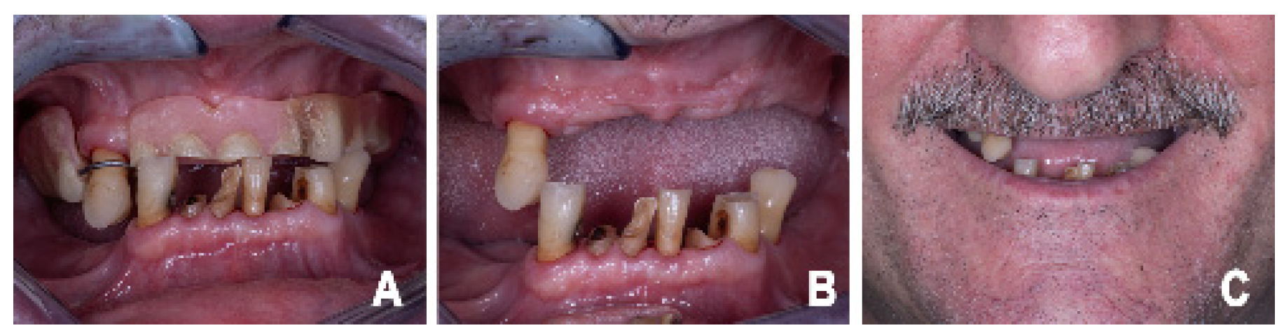 Prosthesis 08 00044 g001