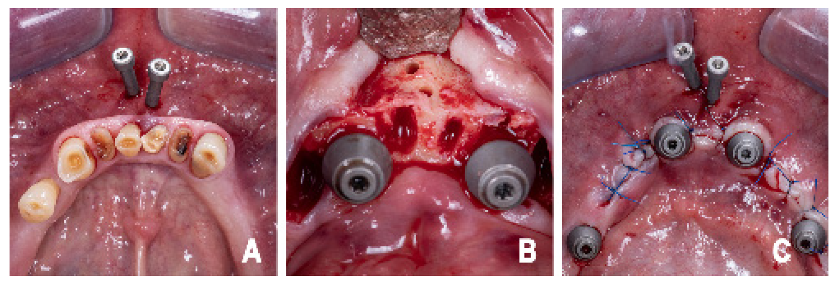 Prosthesis 08 00044 g003