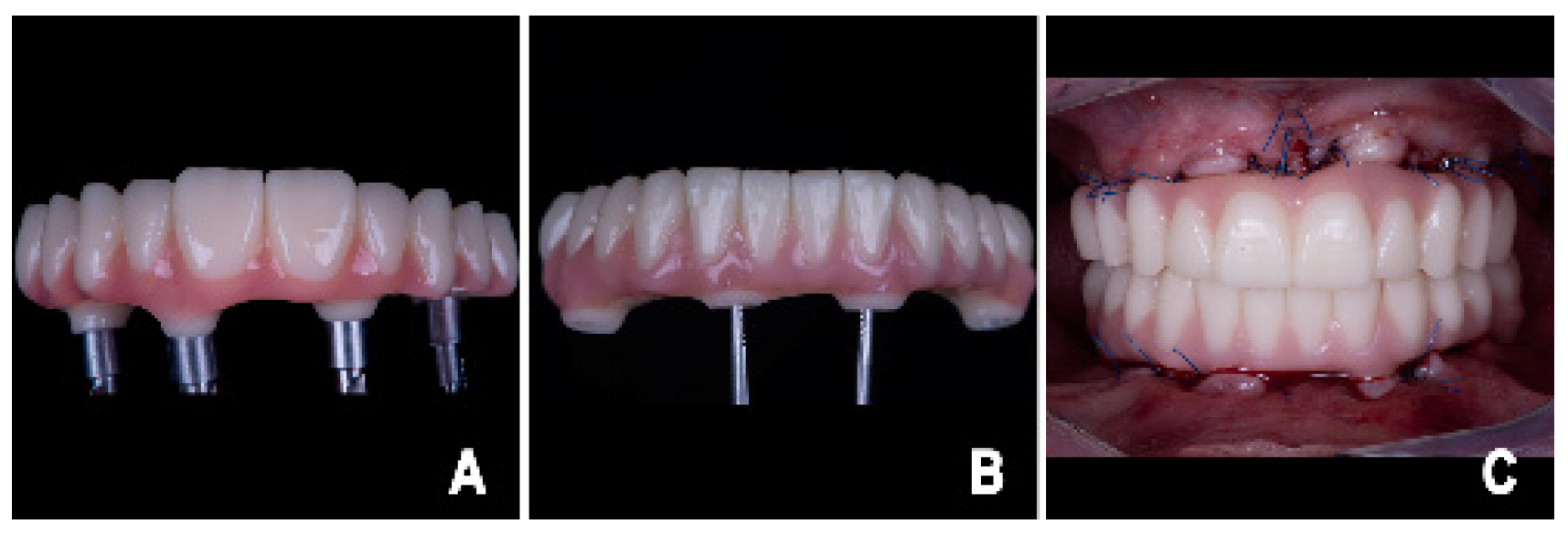 Prosthesis 08 00044 g008