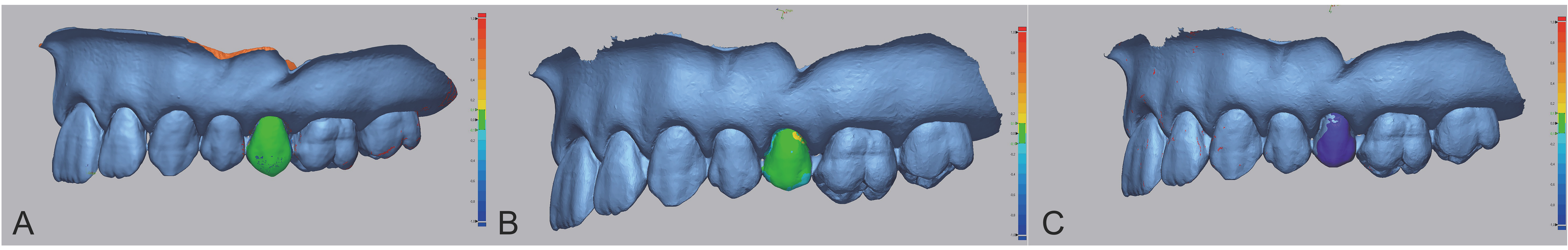 Prosthesis 08 00049 g005