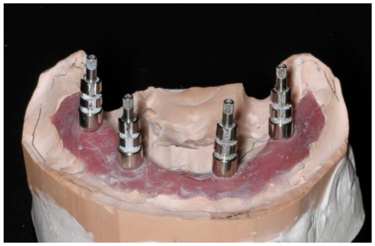 Prosthesis 08 00095 g001 Prosthesis 08 00095 g001