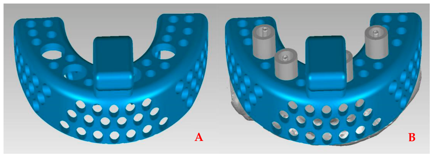Prosthesis 08 00095 g004 Prosthesis 08 00095 g004