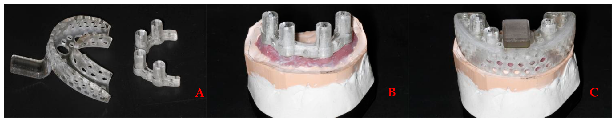 Prosthesis 08 00095 g005 Prosthesis 08 00095 g005