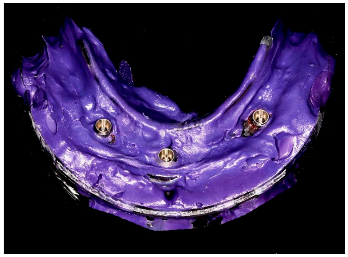 Prosthesis 08 00095 g011 Prosthesis 08 00095 g011
