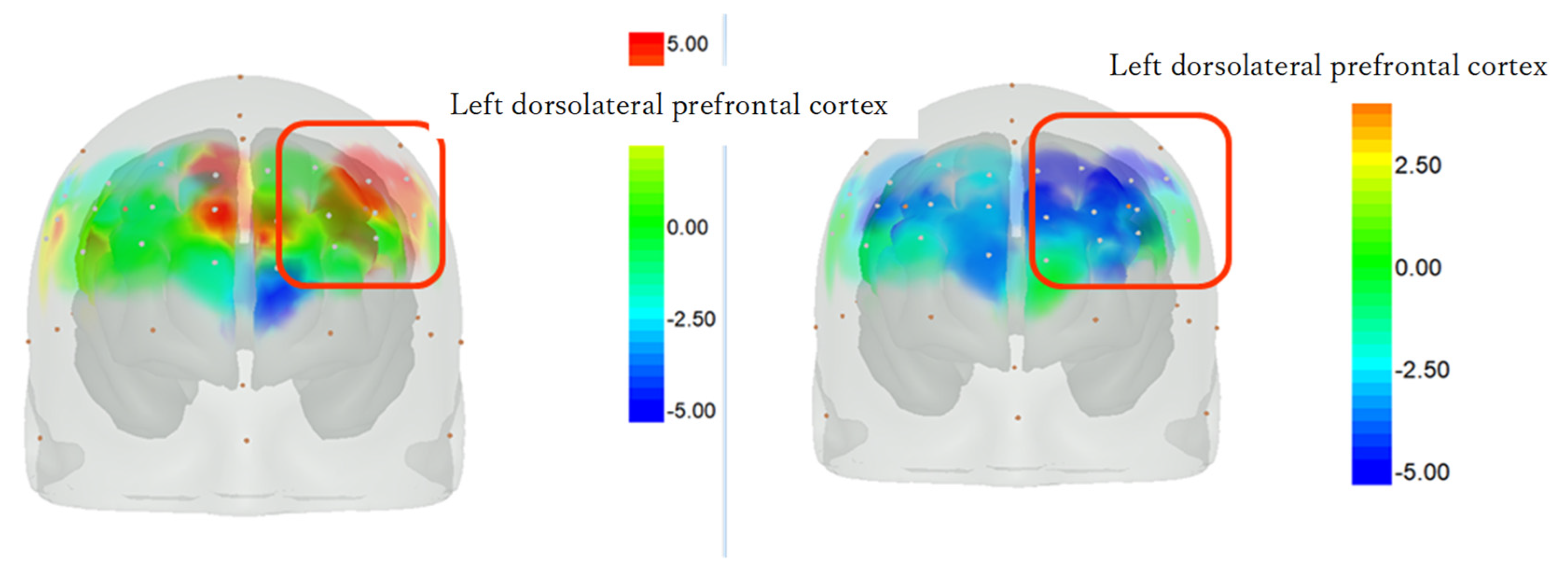 Psychiatryint 05 00010 g005