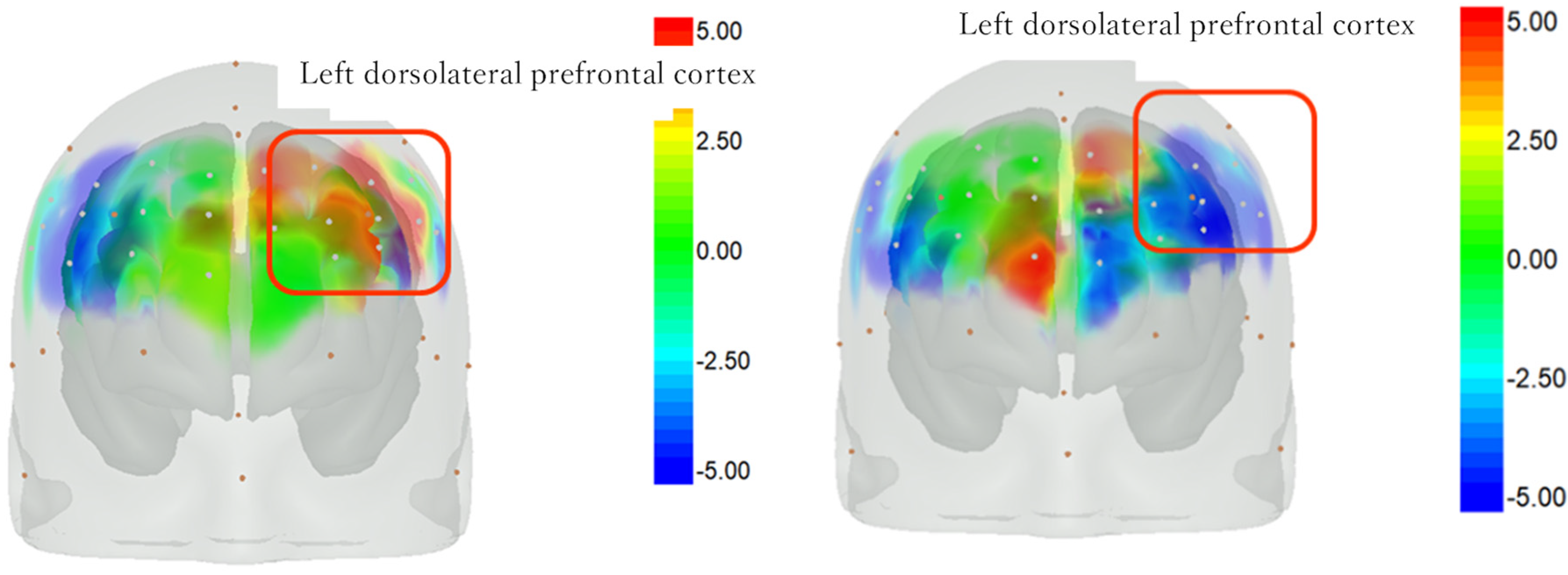 Psychiatryint 05 00010 g007