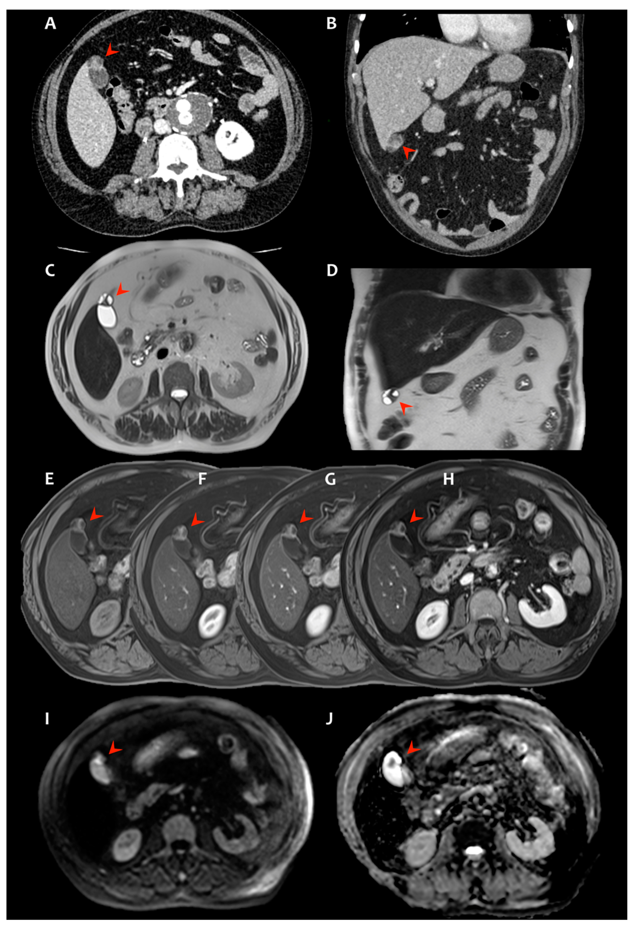 Radiation 02 00004 g001