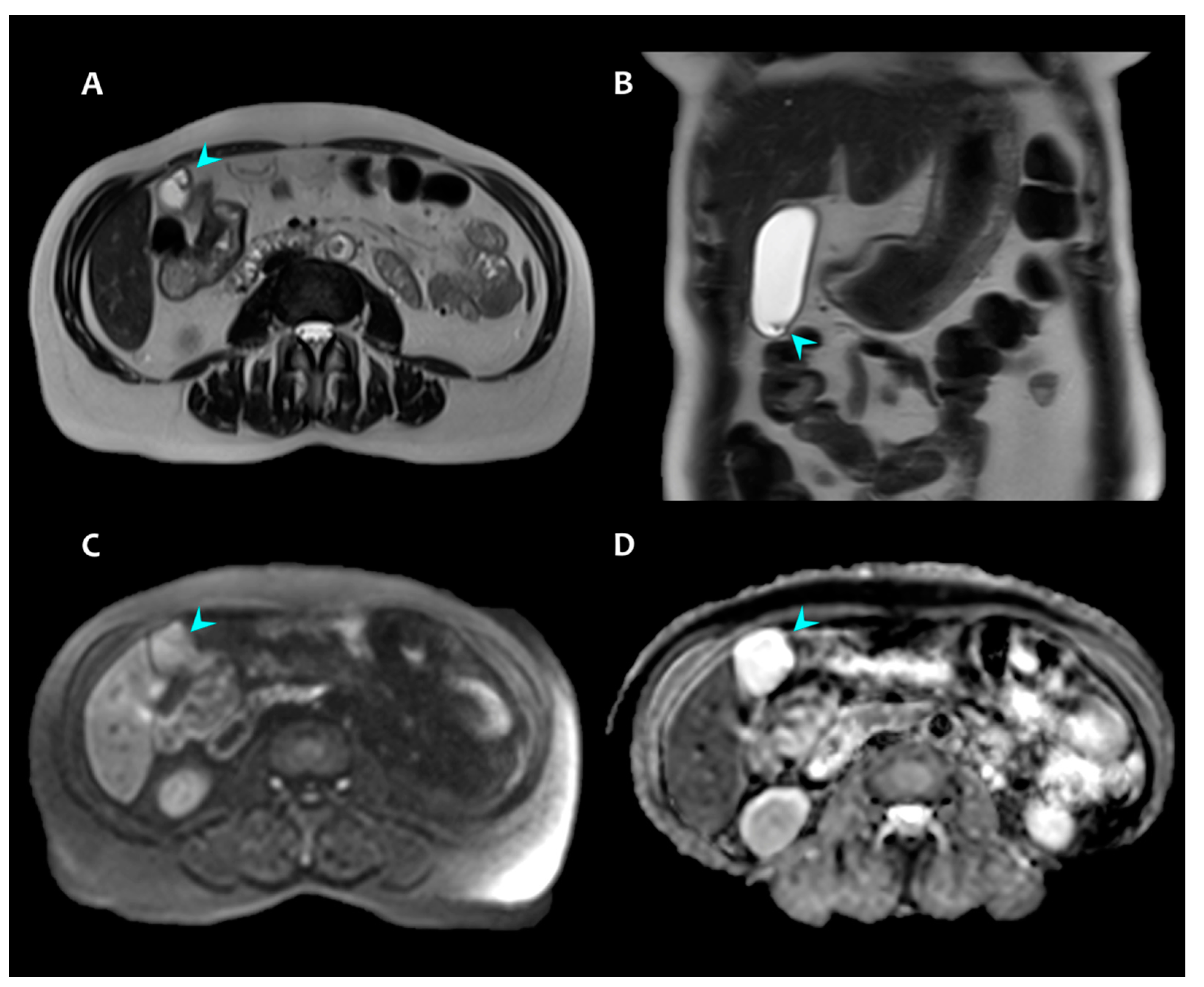 Radiation 02 00004 g003