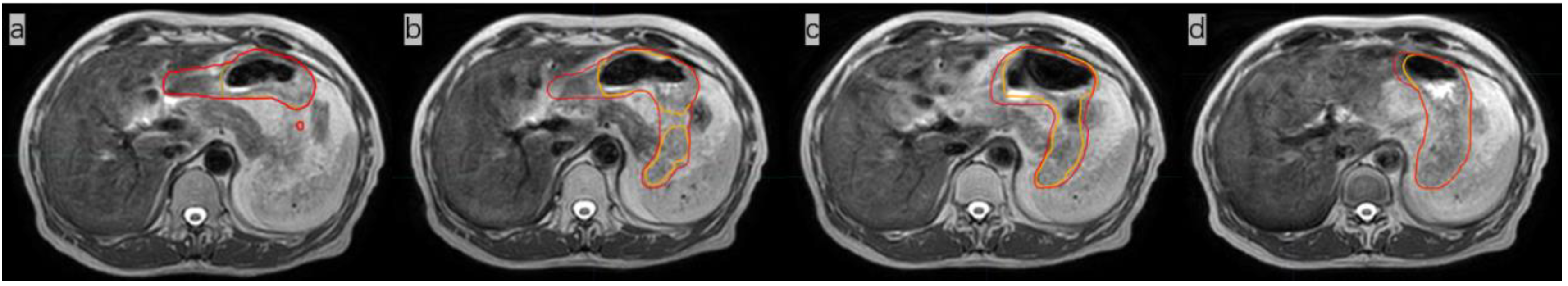 Radiation 02 00019 g002