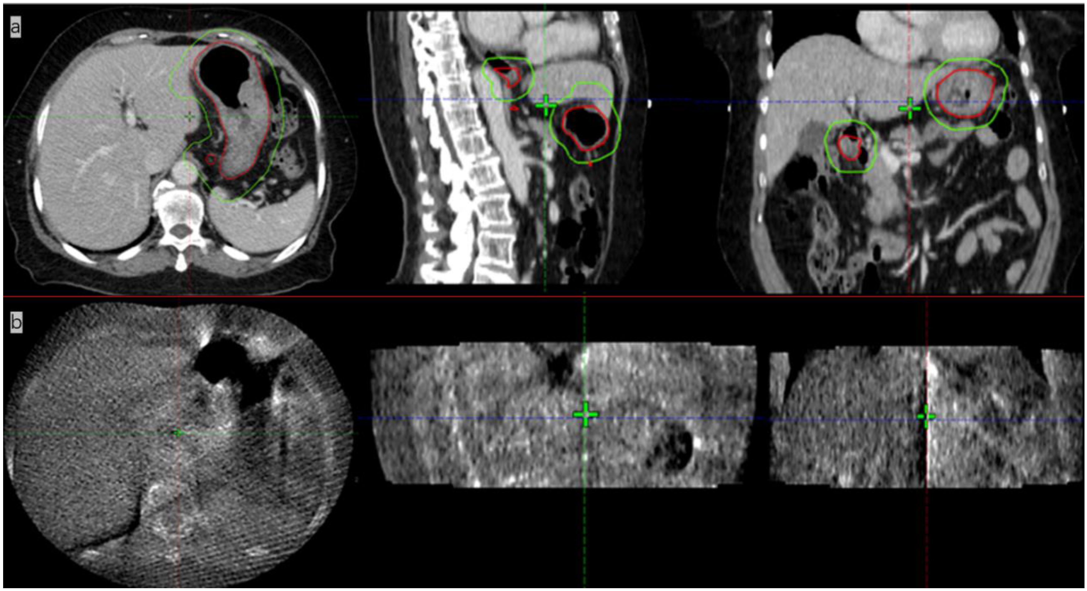 Radiation 02 00019 g005