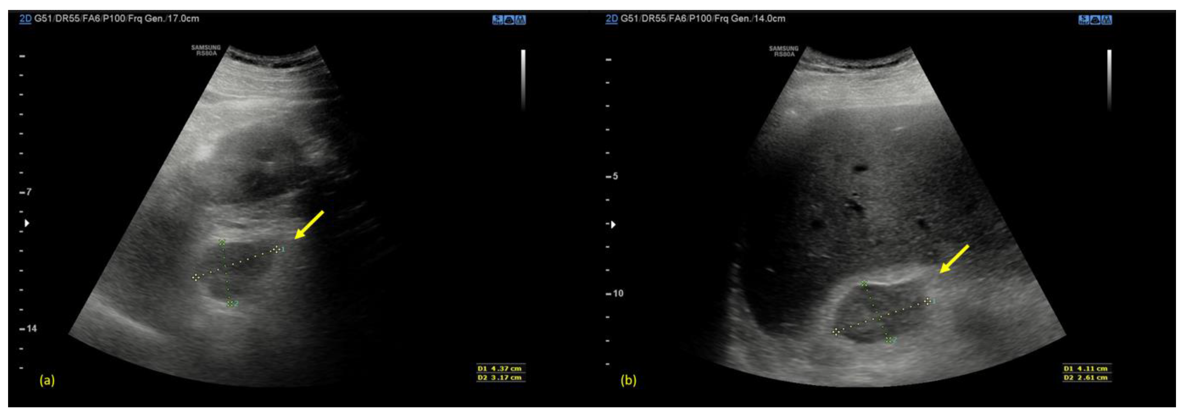 Radiation 02 00023 g001