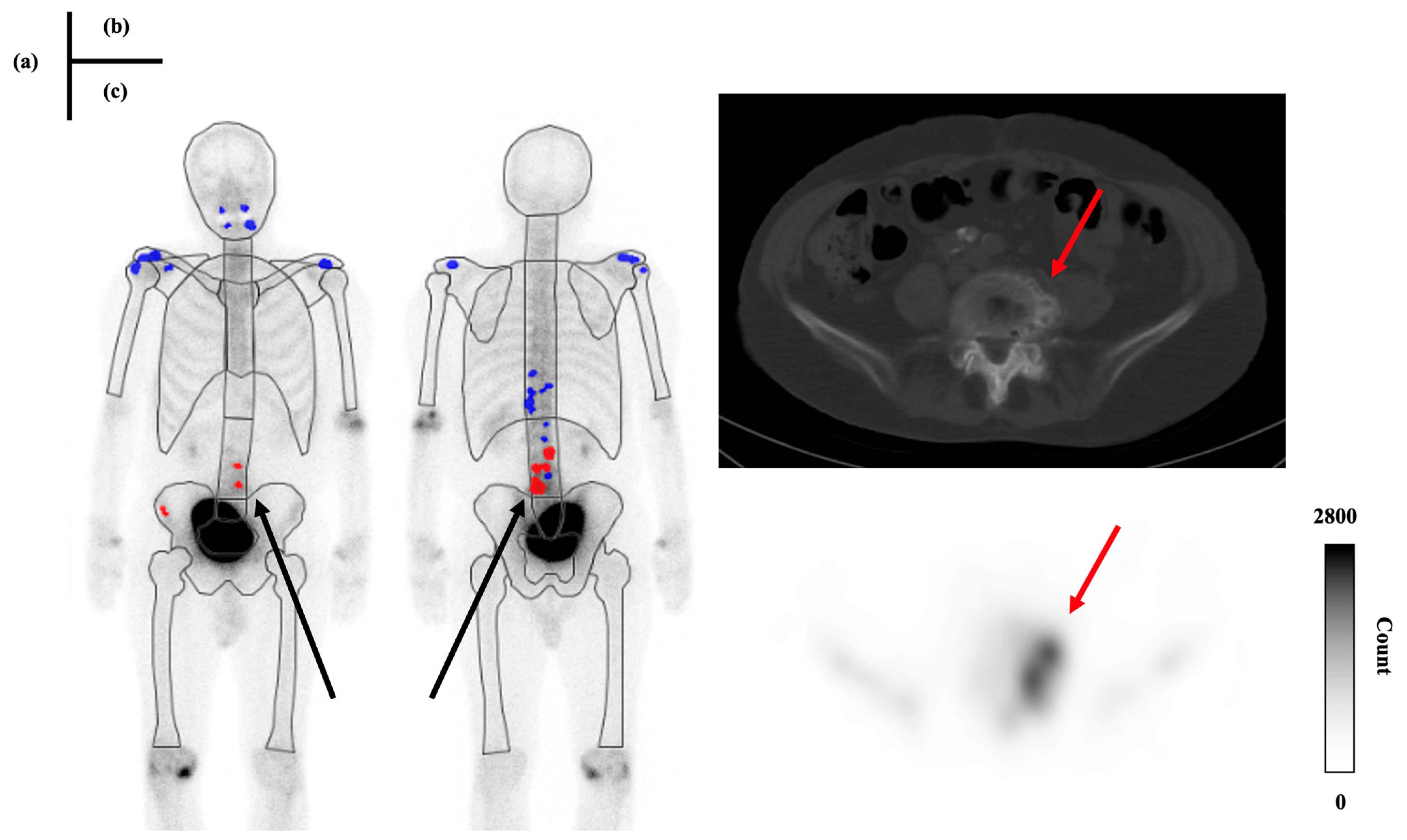 Radiation 05 00005 g010