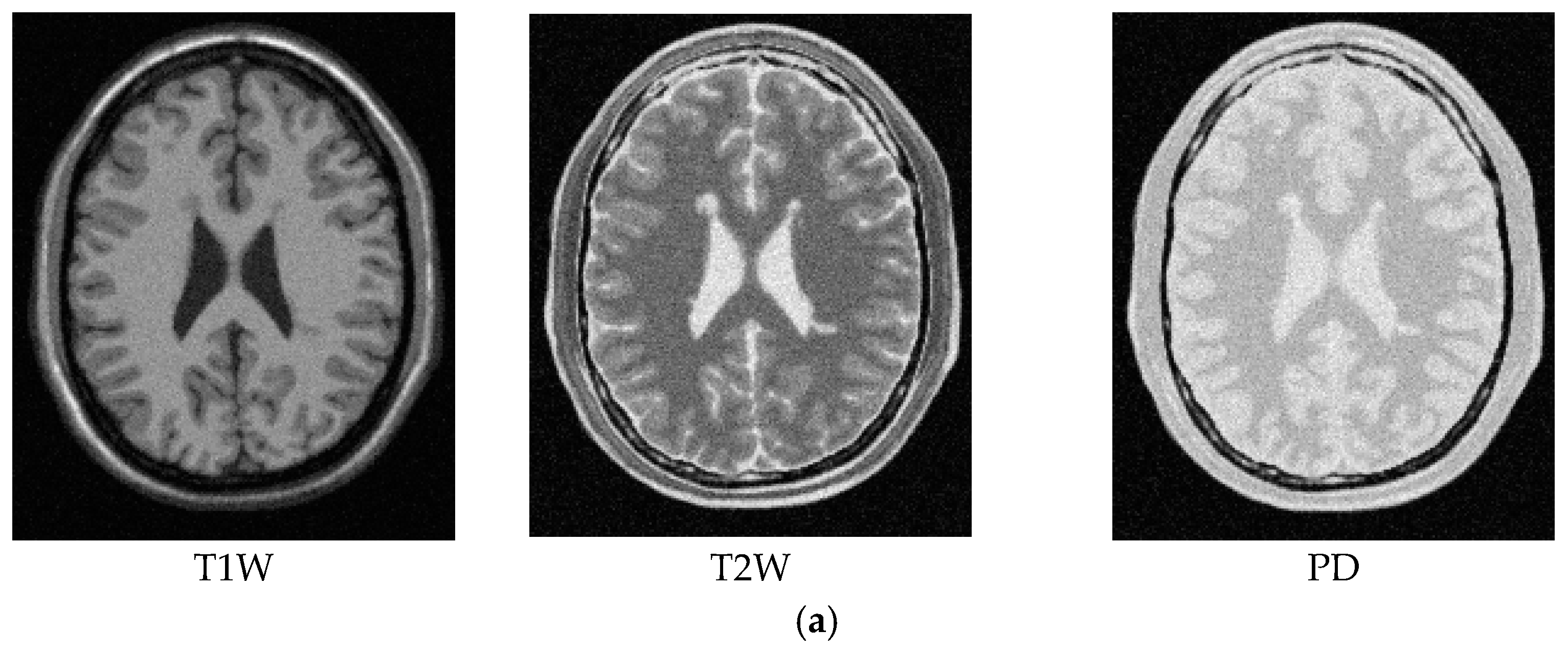 Remotesensing 09 01174 g008a Remotesensing 09 01174 g008a