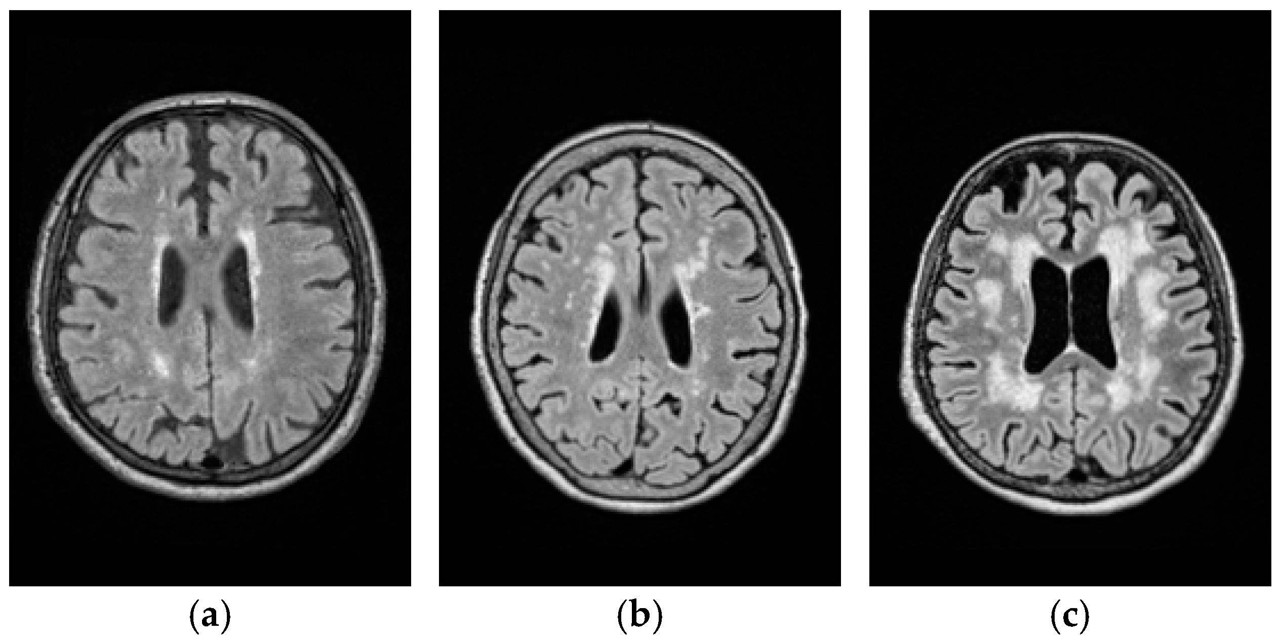 Remotesensing 09 01174 g011 Remotesensing 09 01174 g011
