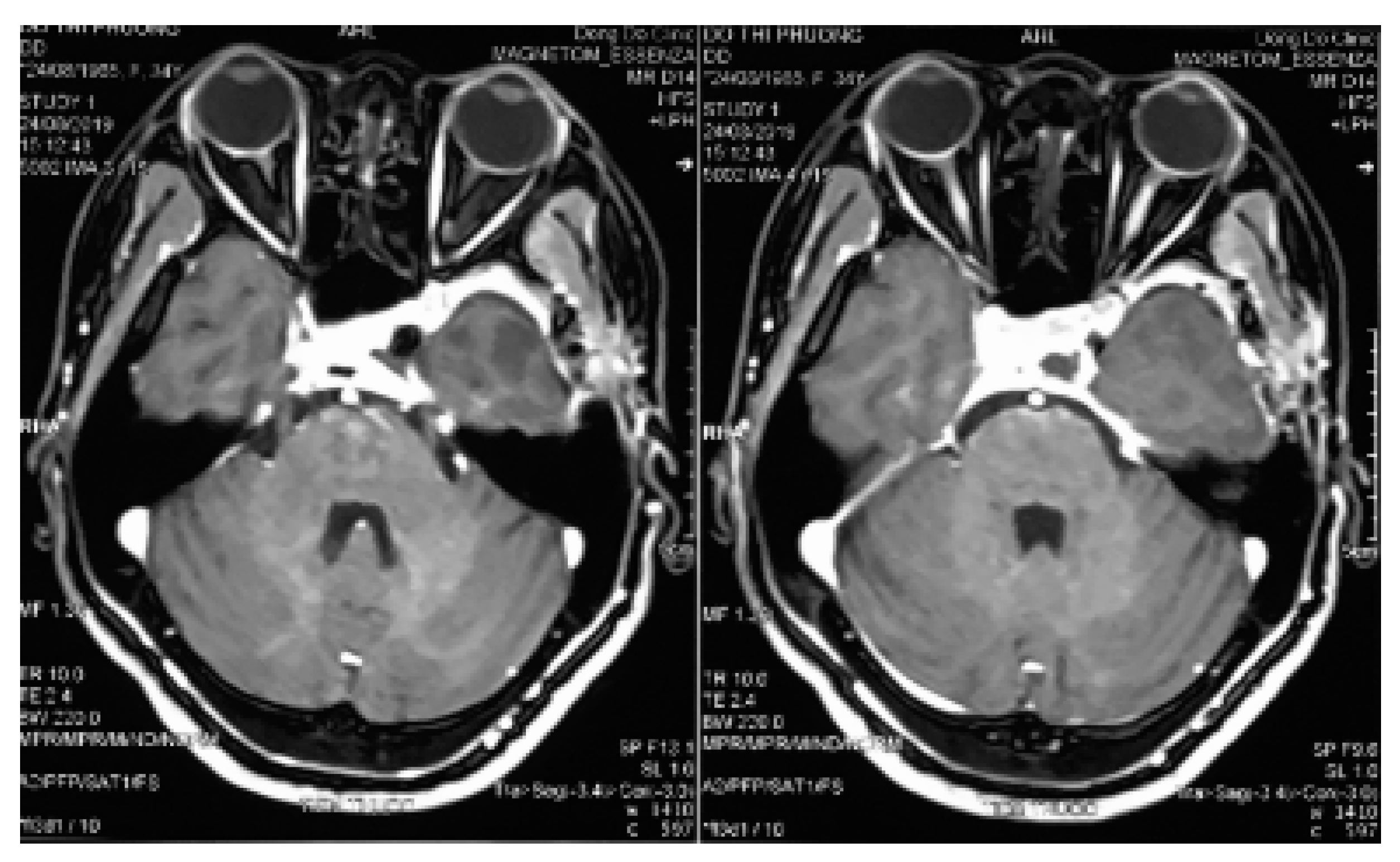 Reports 03 00016 g004a