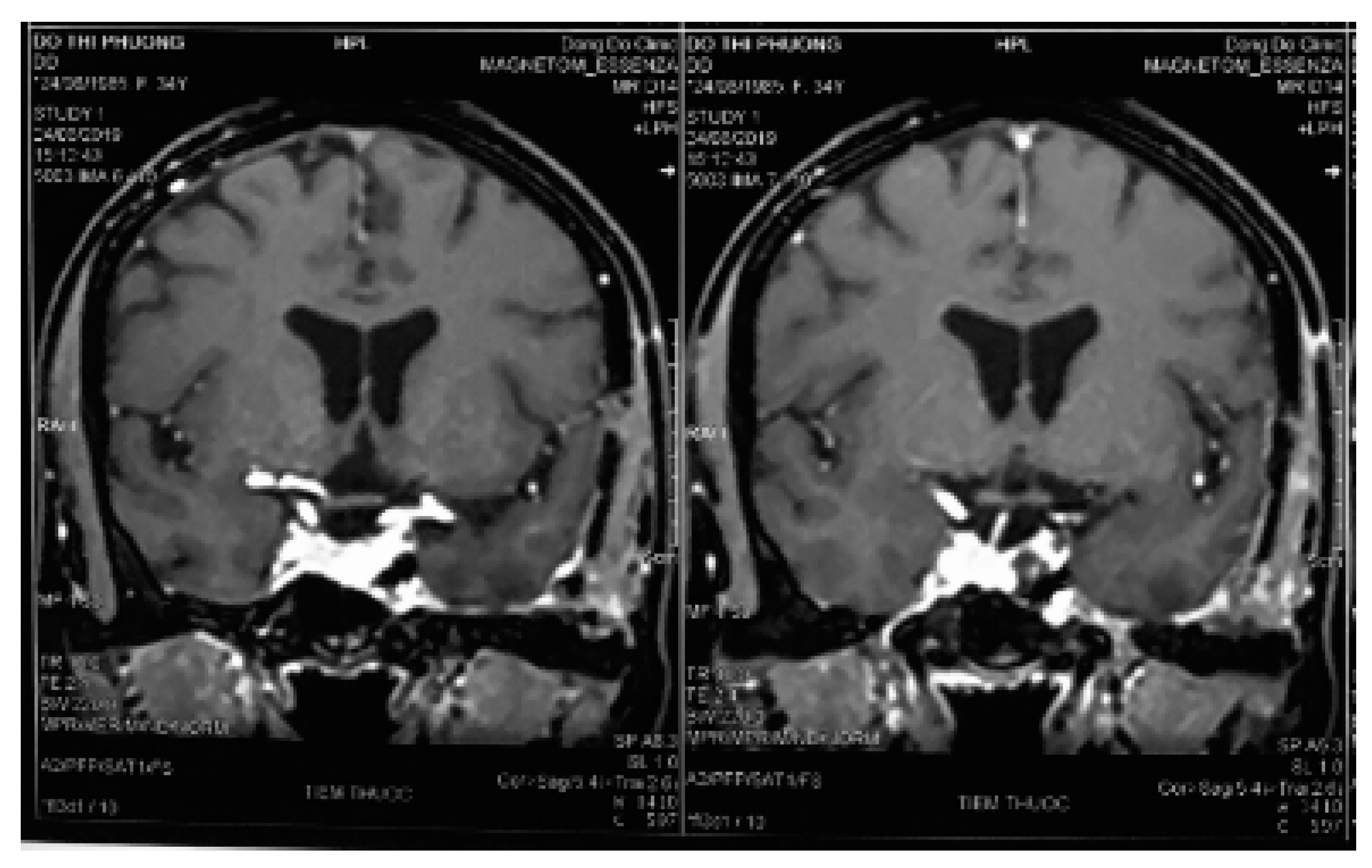 Reports 03 00016 g004b