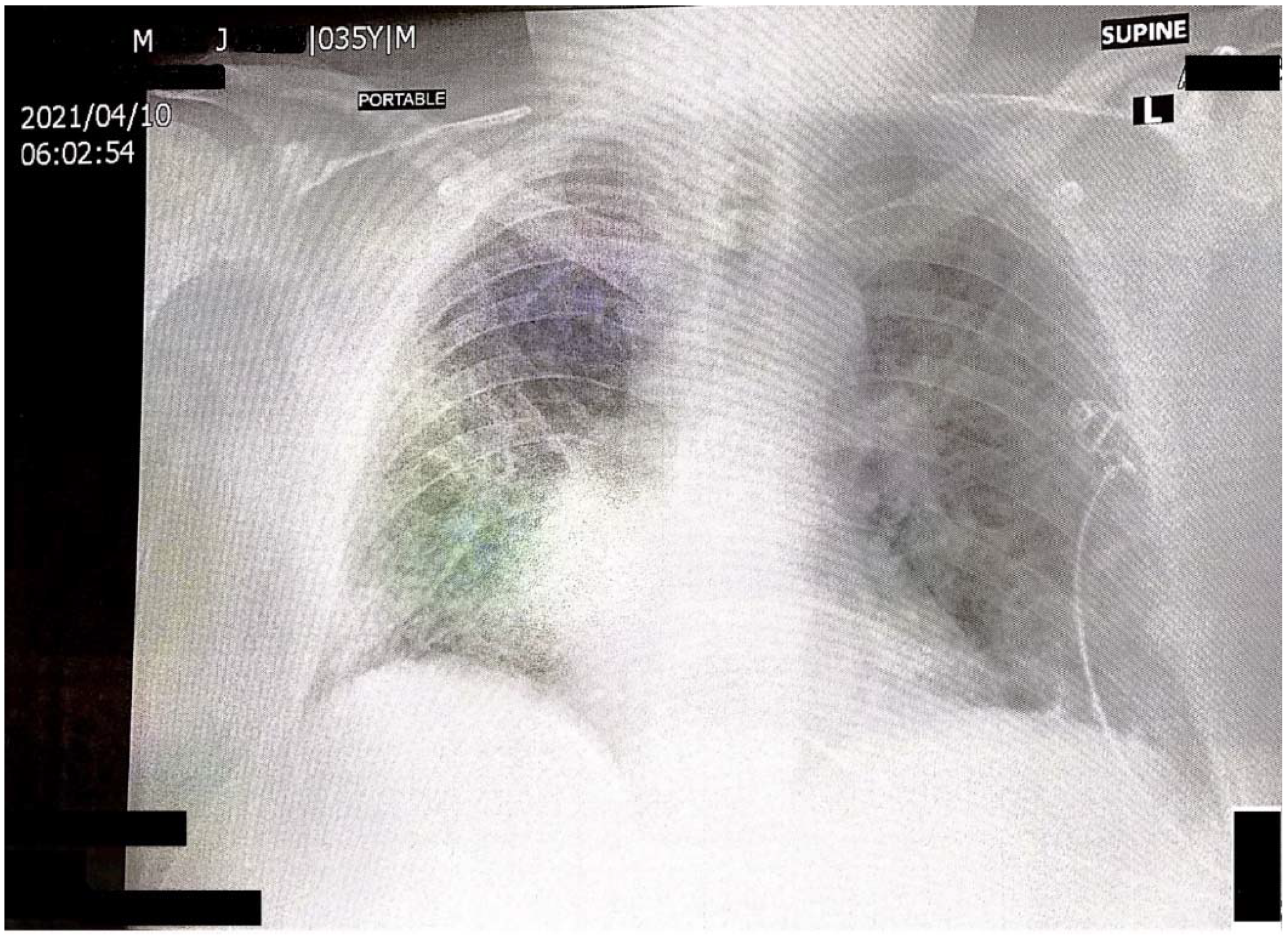 Reports 05 00011 g001