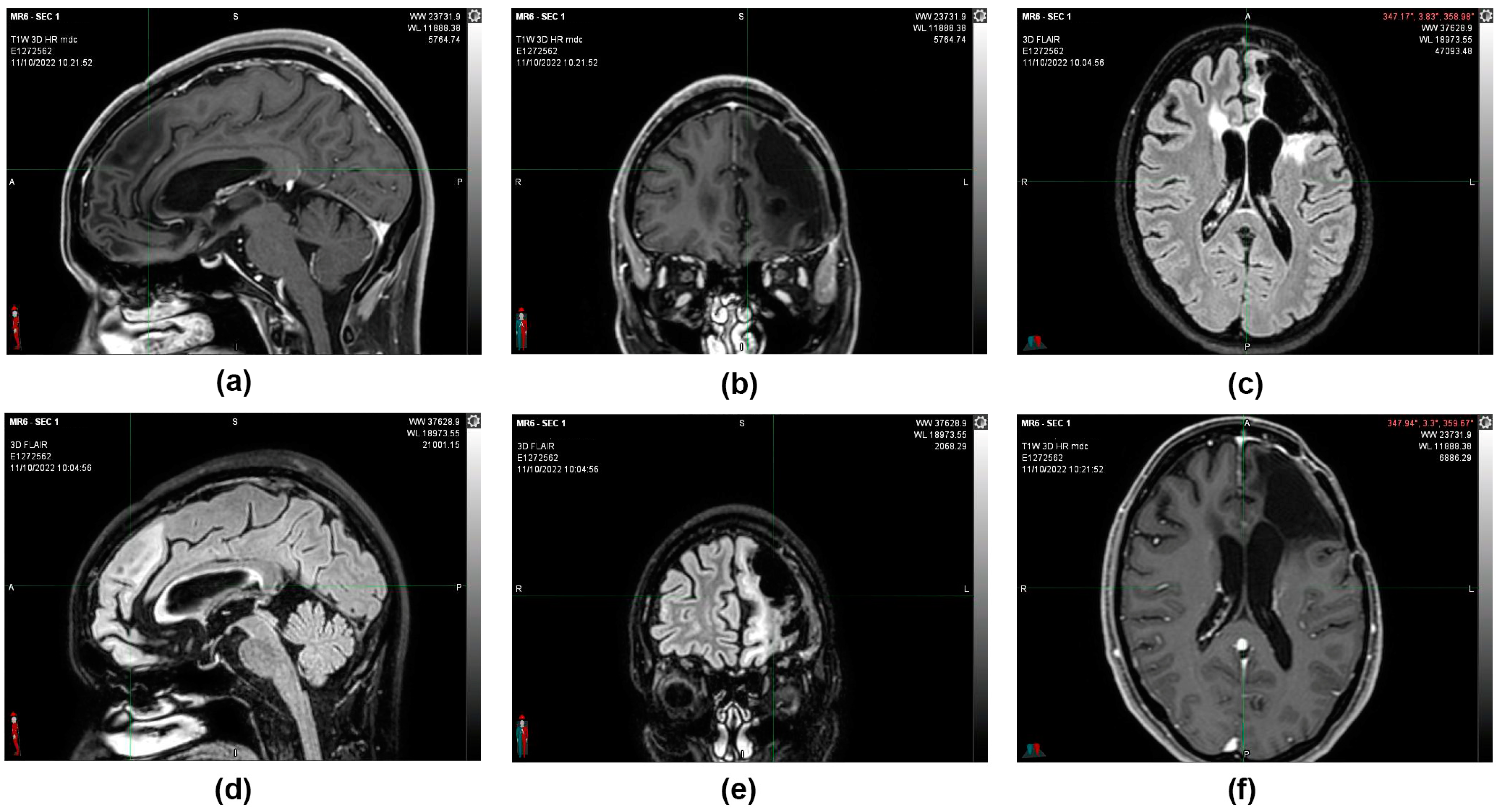 Reports 06 00022 g004 Reports 06 00022 g004