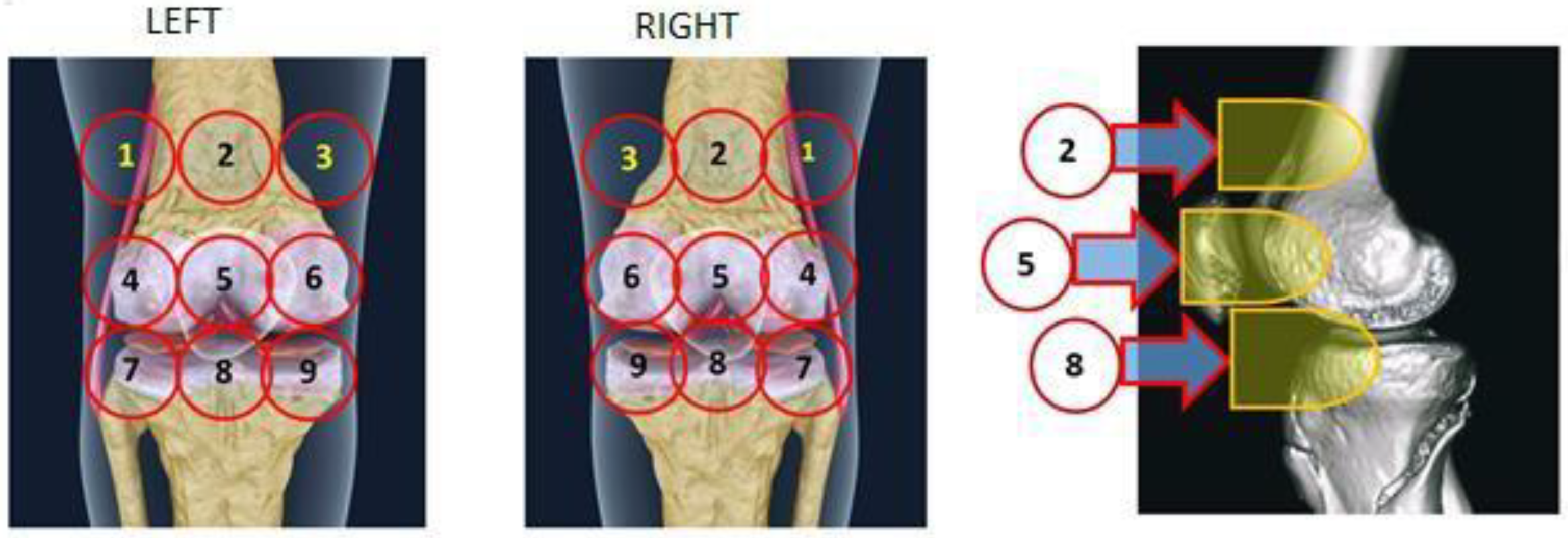 Rheumato 02 00008 g002