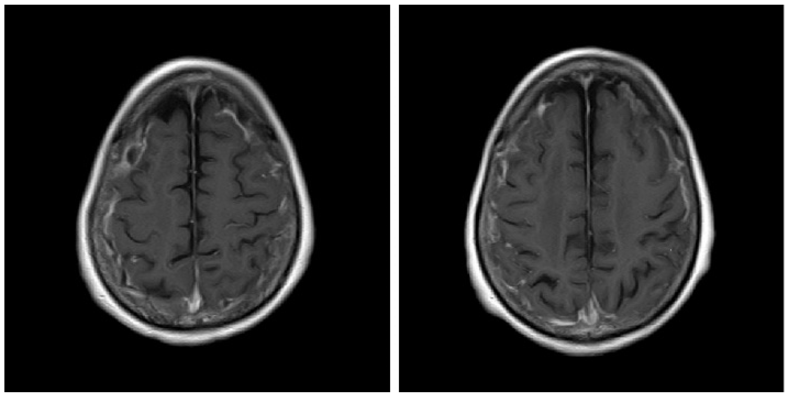 Rheumato 02 00009 g001