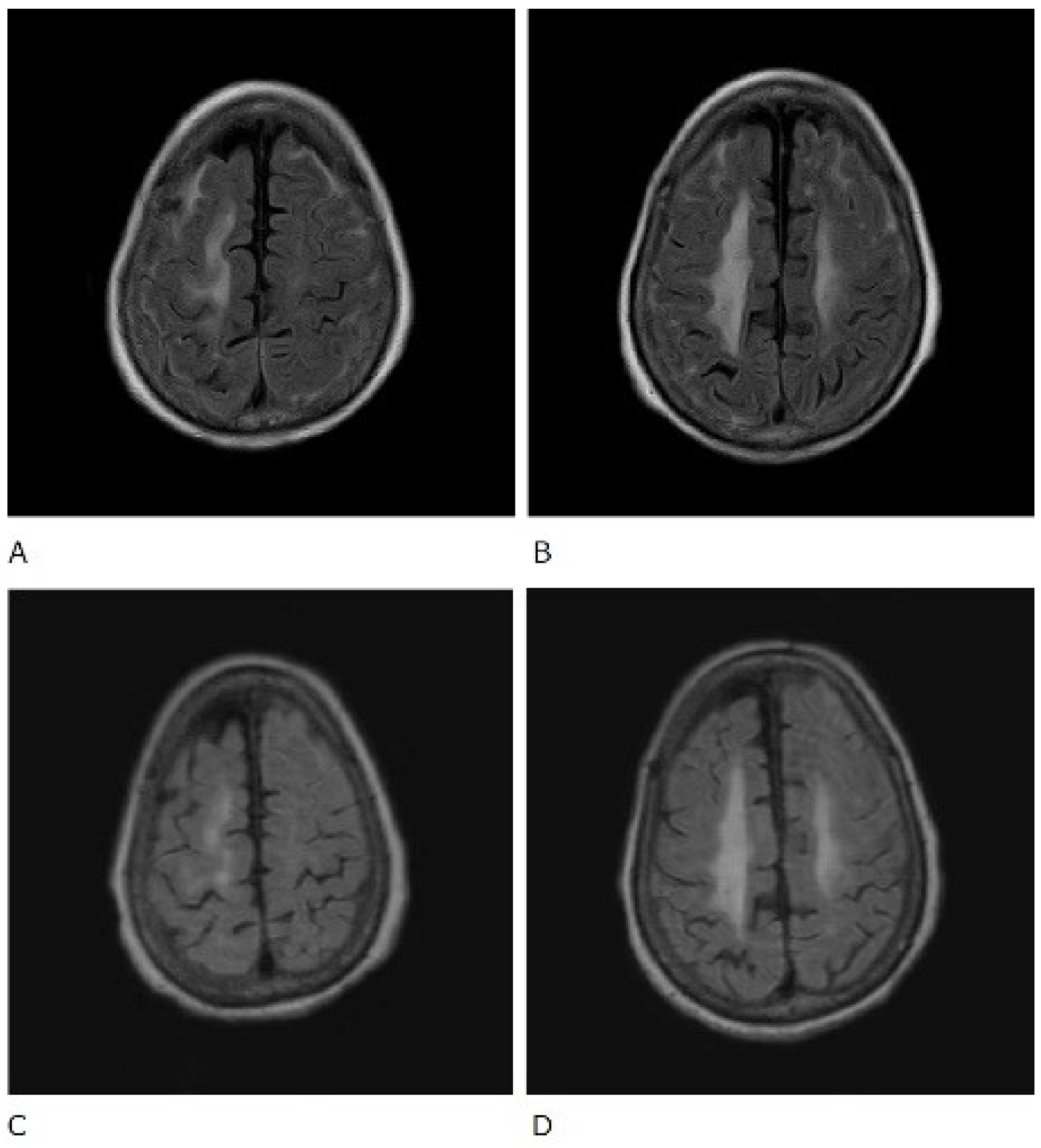 Rheumato 02 00009 g002