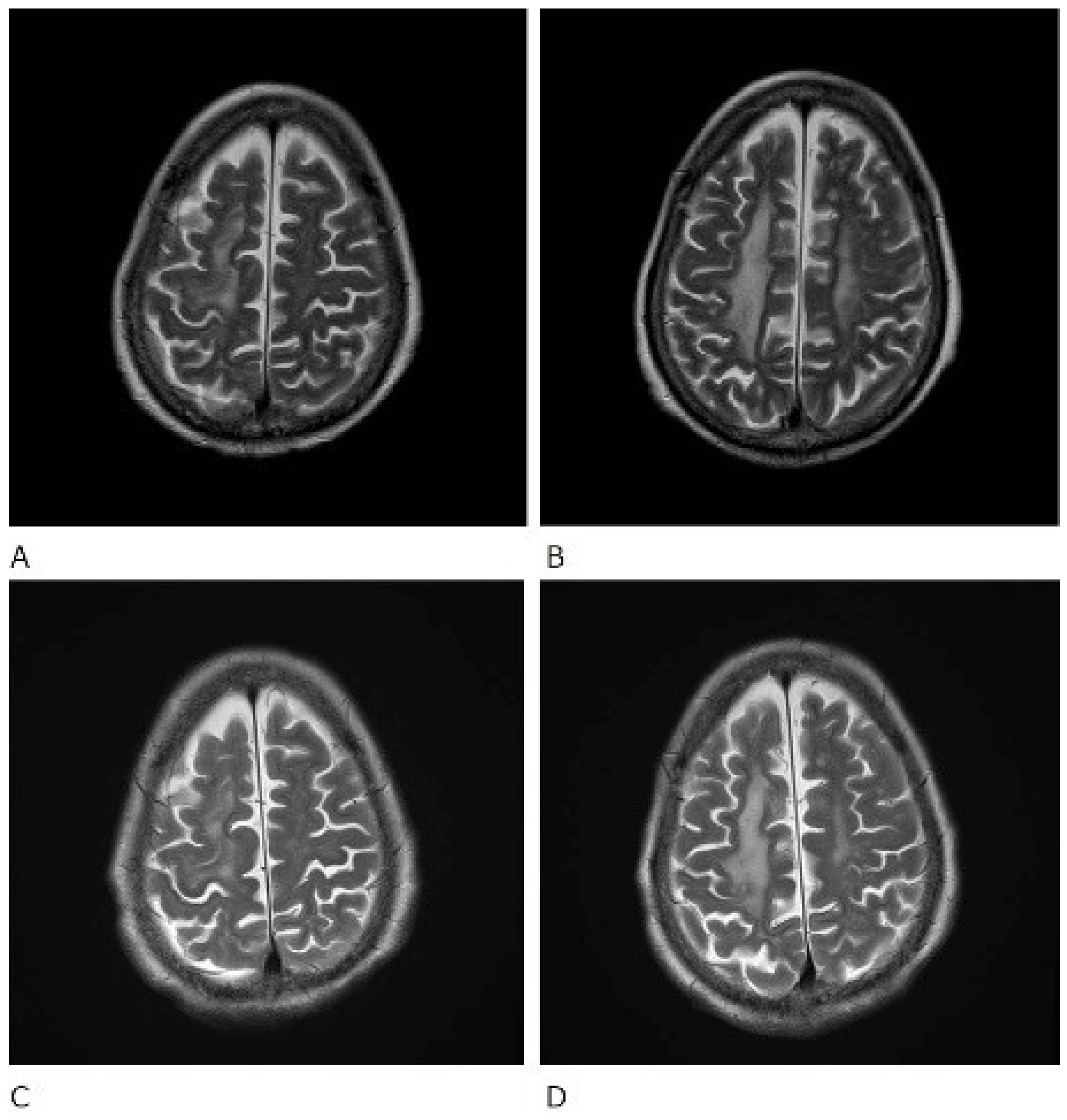 Rheumato 02 00009 g003