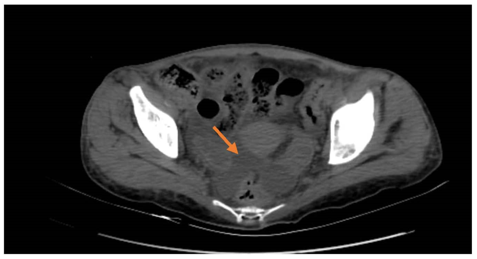 Rheumato 02 00013 g001