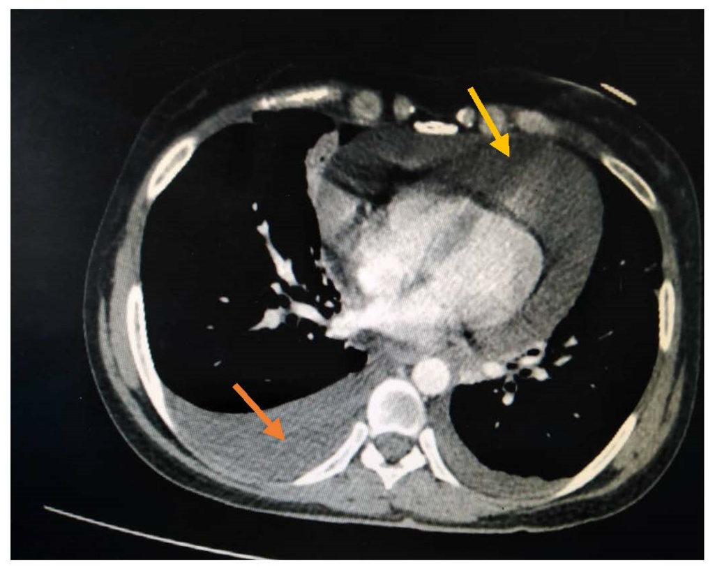 Rheumato 02 00013 g002