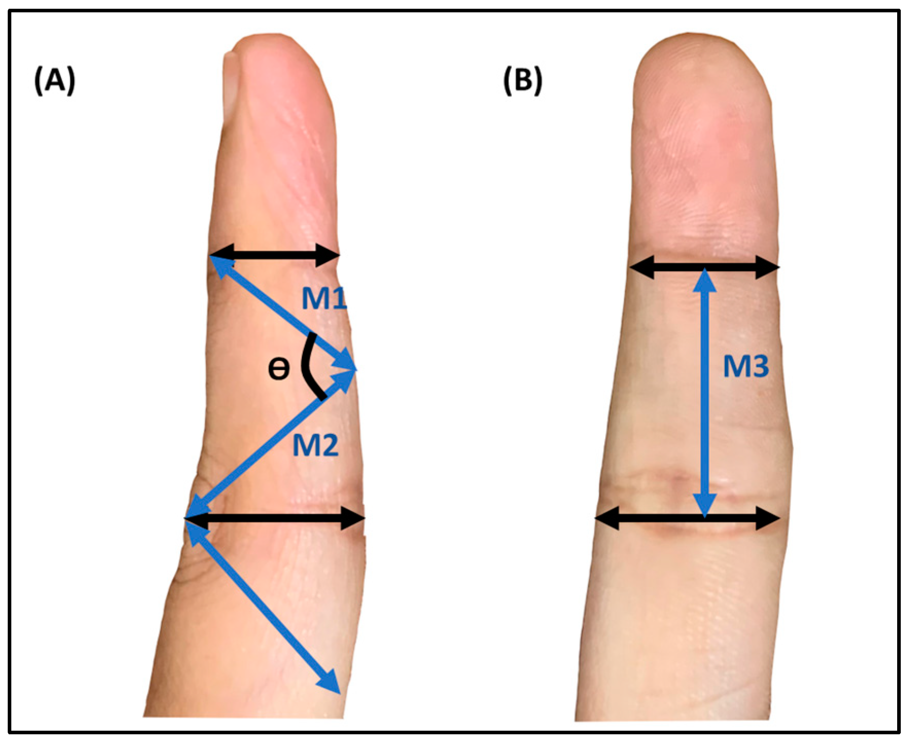 Rheumato 03 00004 g002