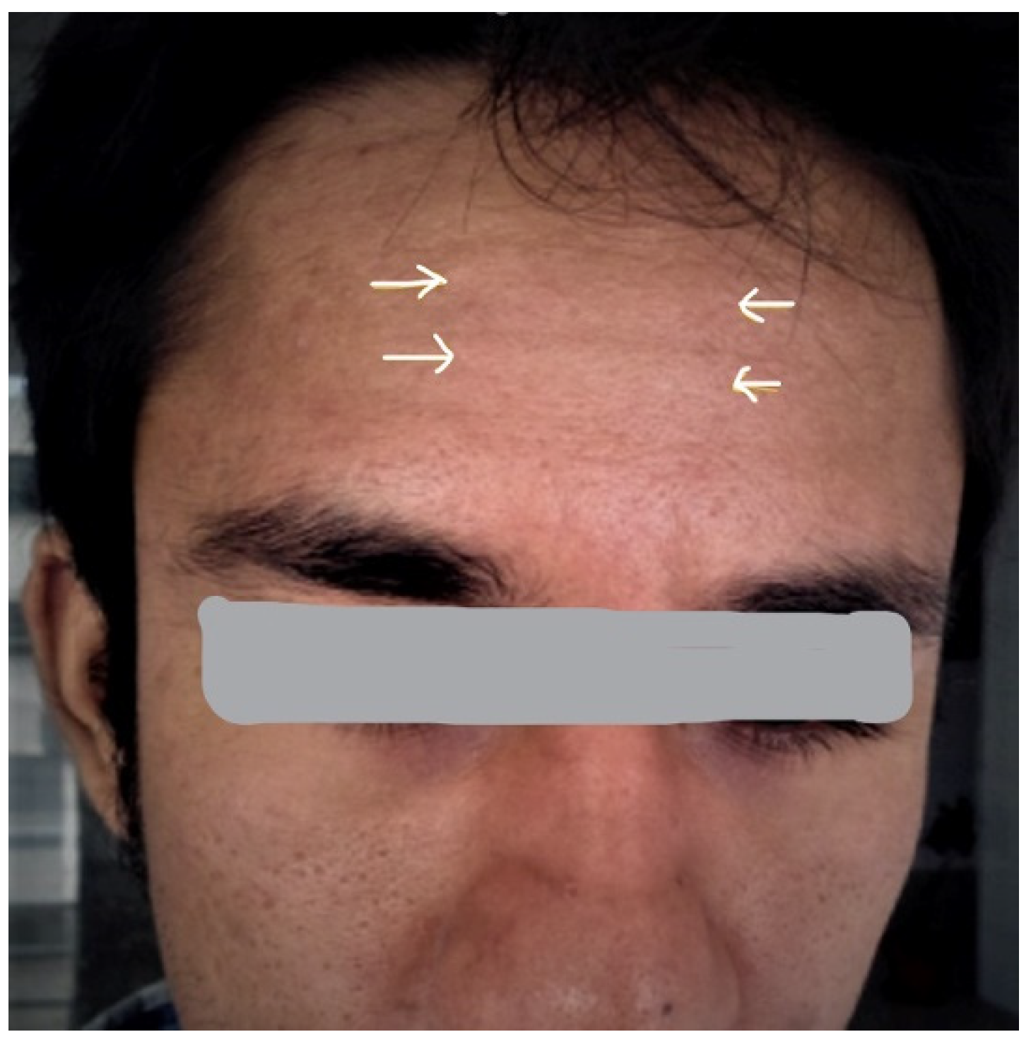 Rheumato 03 00008 g001