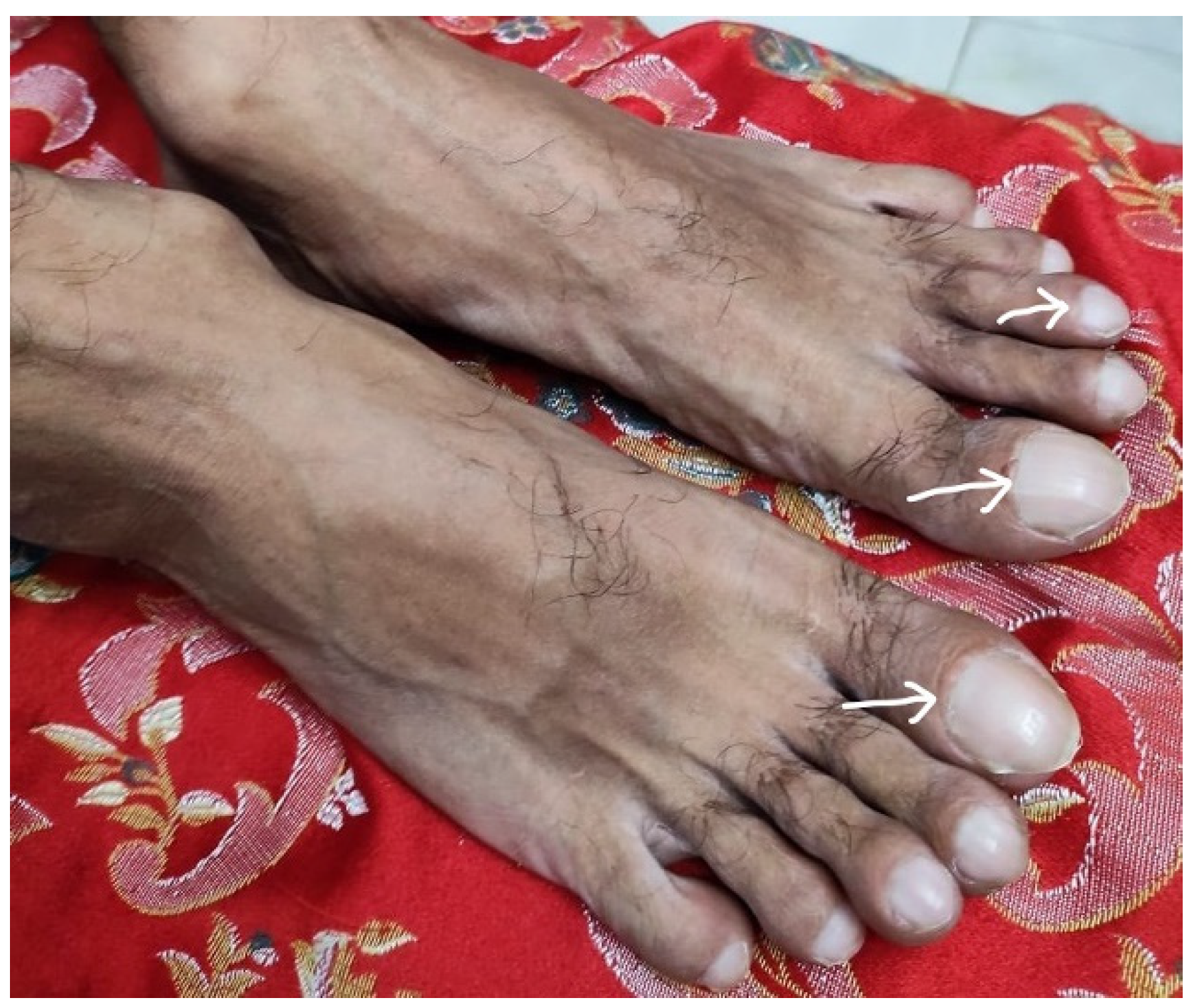 Rheumato 03 00008 g003