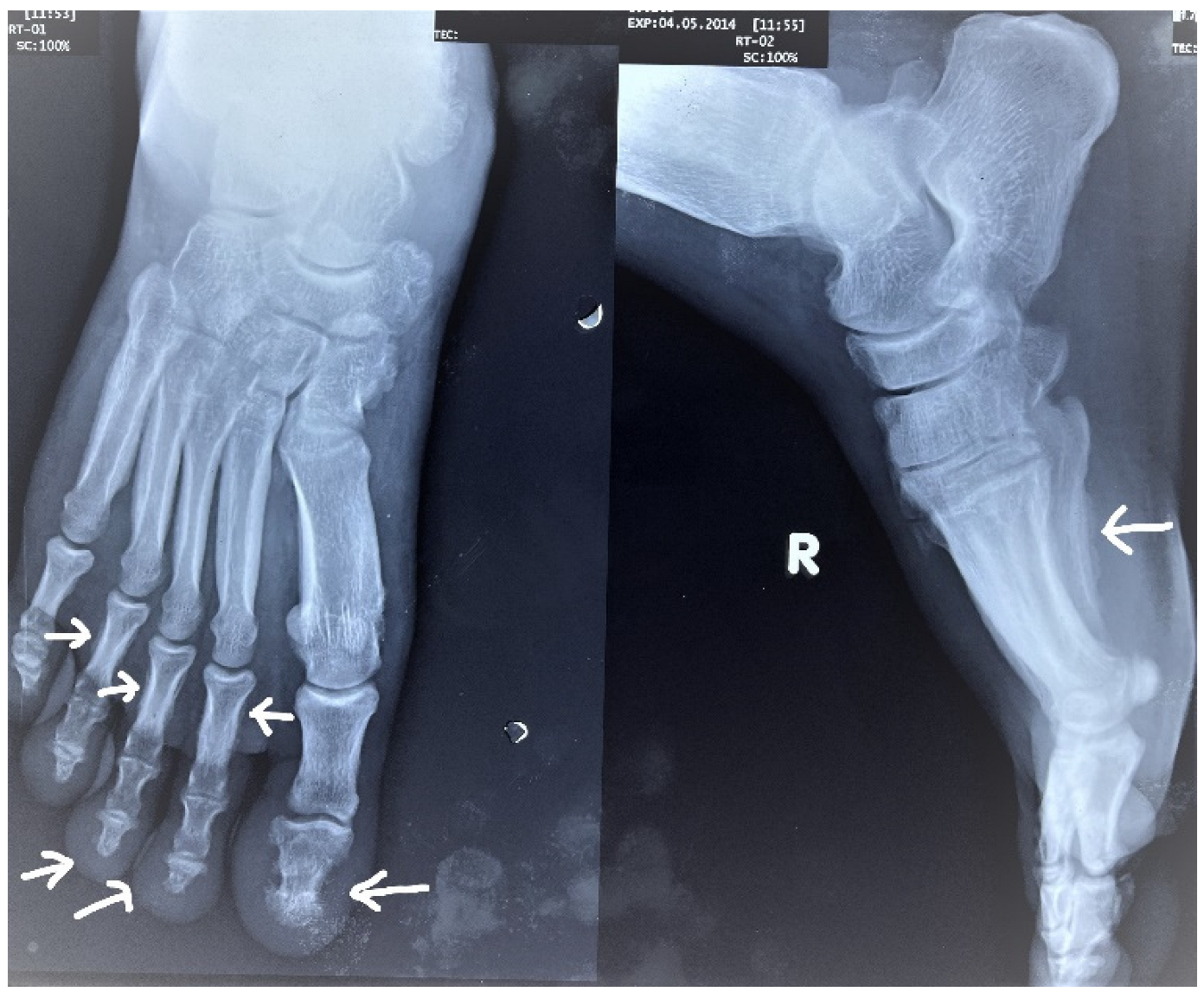 Rheumato 03 00008 g005