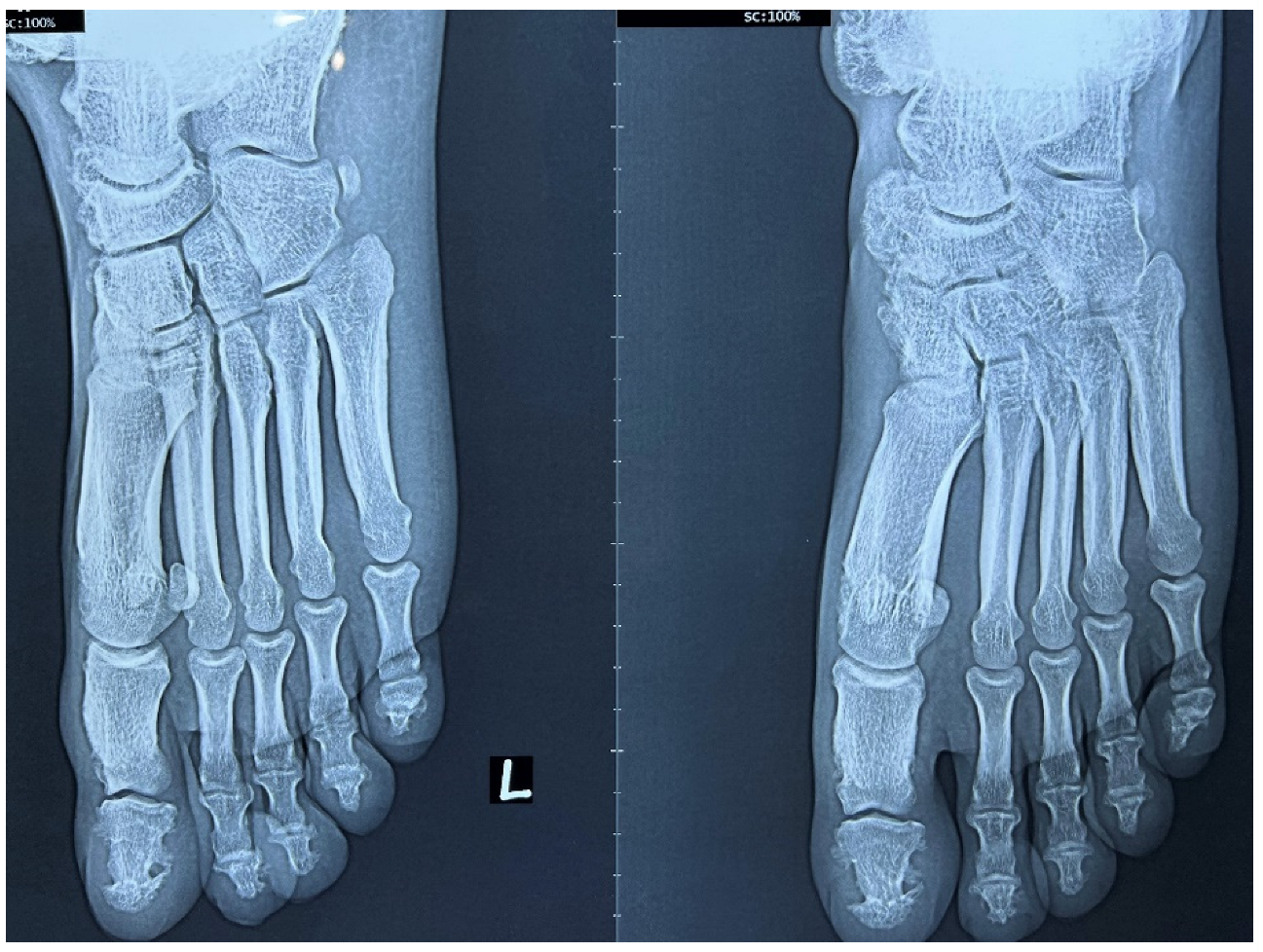 Rheumato 03 00008 g007