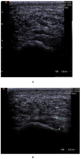 Rheumato 03 00012 g0a2a Rheumato 03 00012 g0a2a