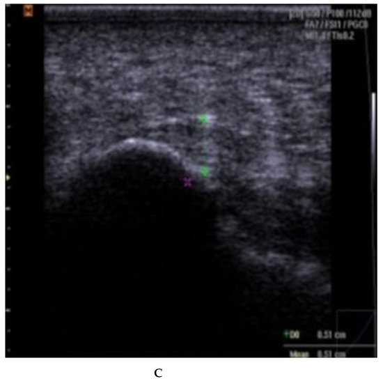 Rheumato 03 00012 g0a2b