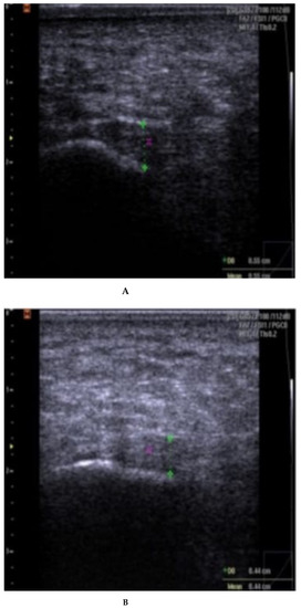 Rheumato 03 00012 g0a3a Rheumato 03 00012 g0a3a