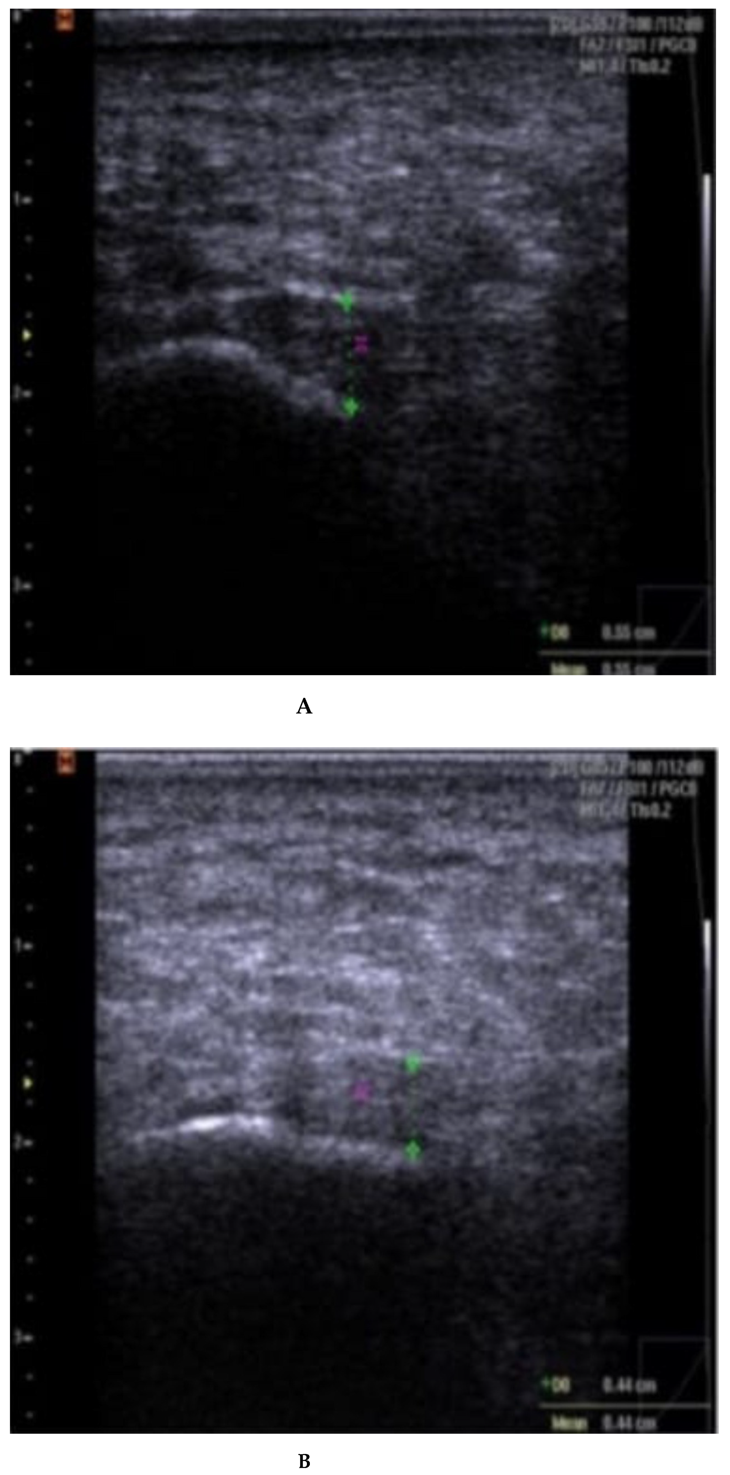 Rheumato 03 00012 g0a3a