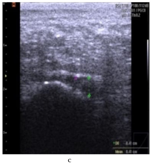 Rheumato 03 00012 g0a3b