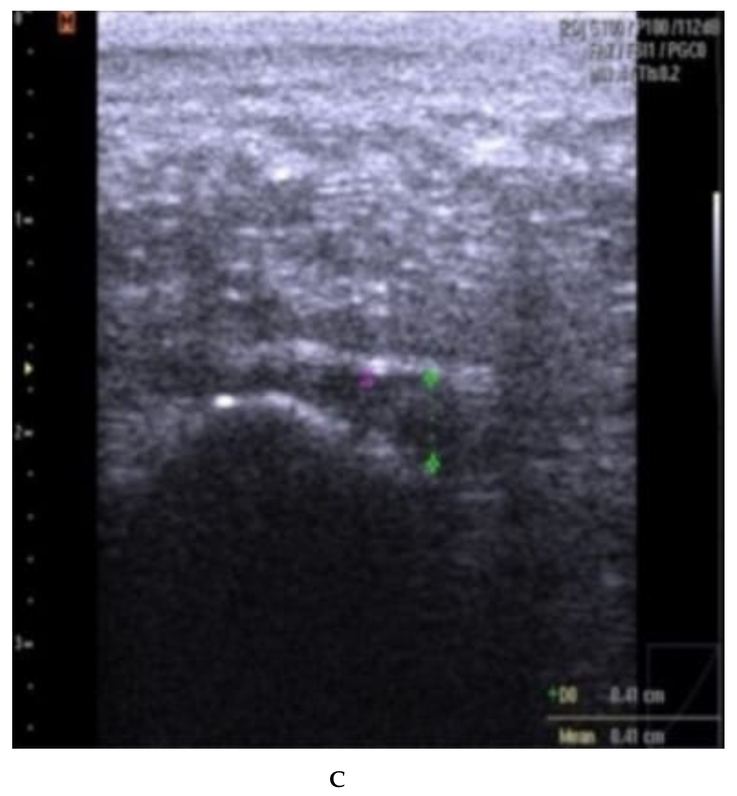 Rheumato 03 00012 g0a3b