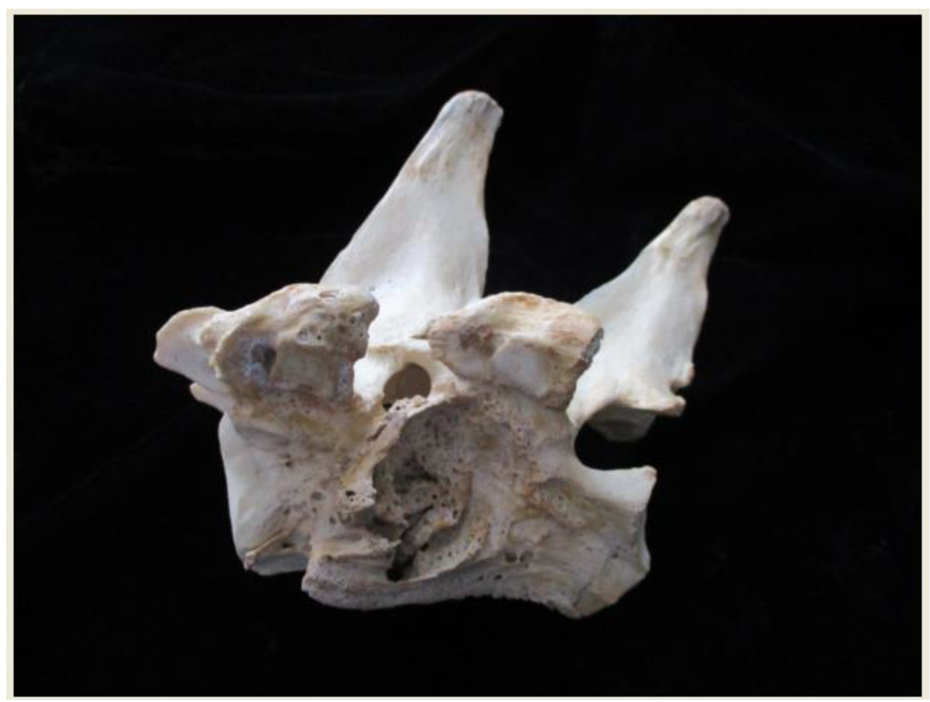 Rheumato 03 00016 g001