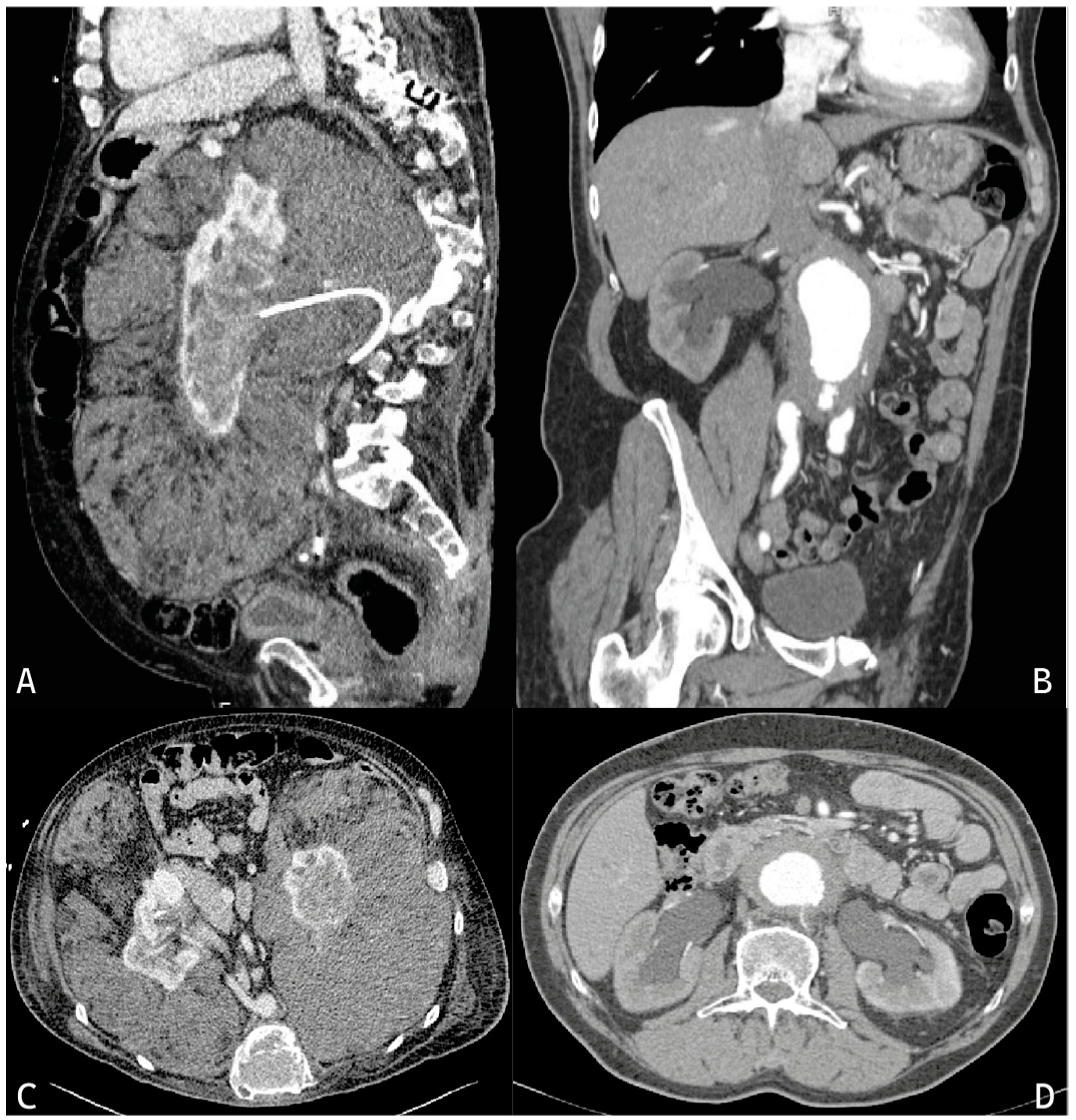 Rheumato 04 00001 g001